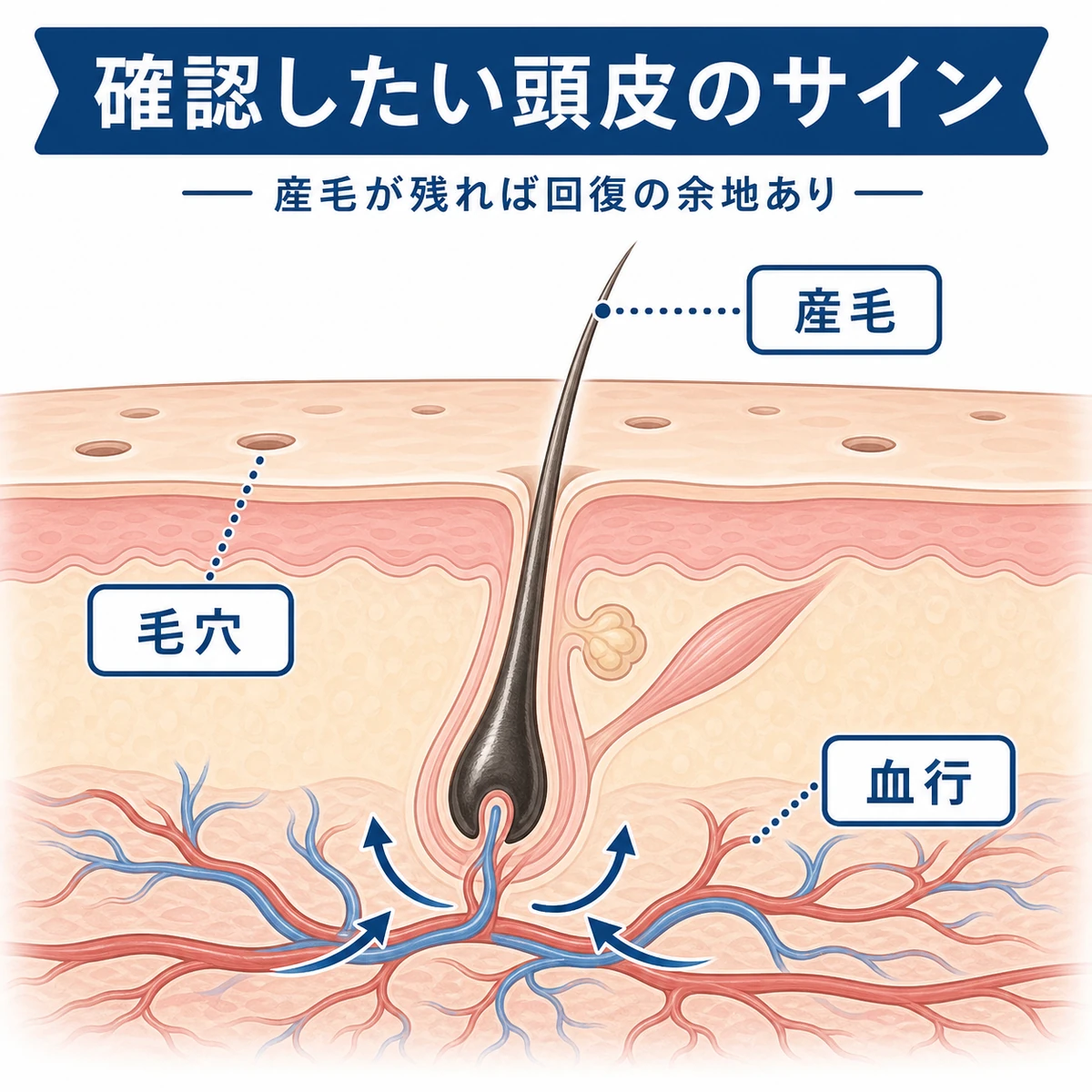 毛穴と産毛と血行から頭皮の状態を確かめる様子を表した医療イラスト