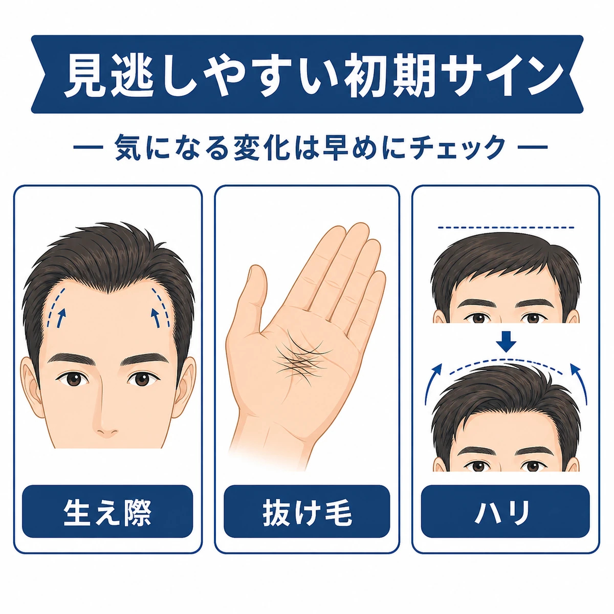 M字はげの初期サインを生え際・抜け毛・髪のハリの3点で表した医療イラスト