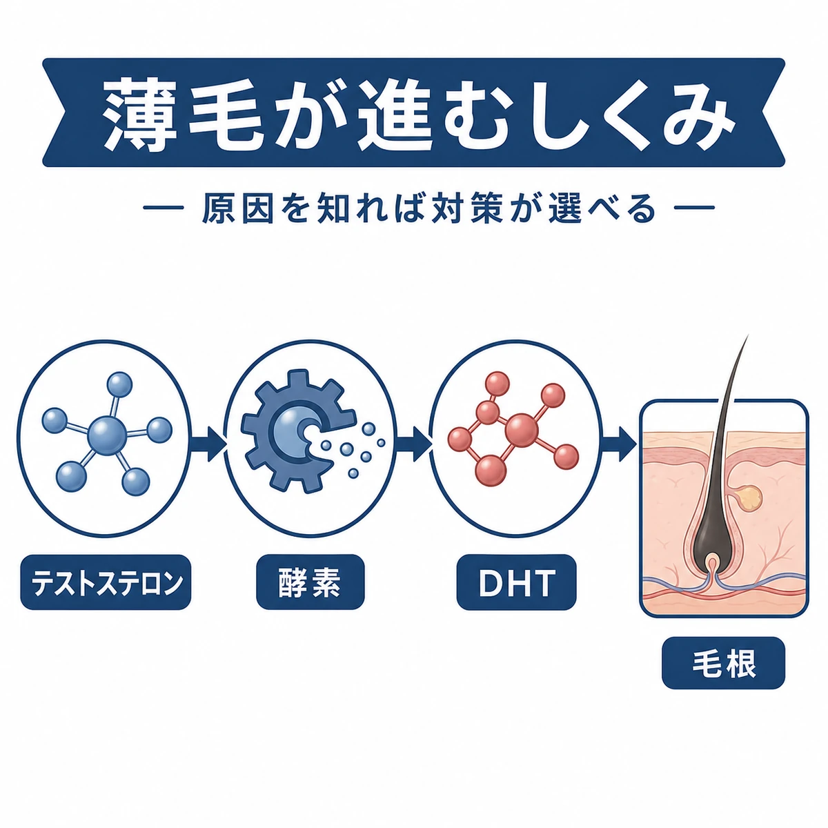 テストステロンからDHTへ変化し毛根に作用する流れを表した医療イラスト