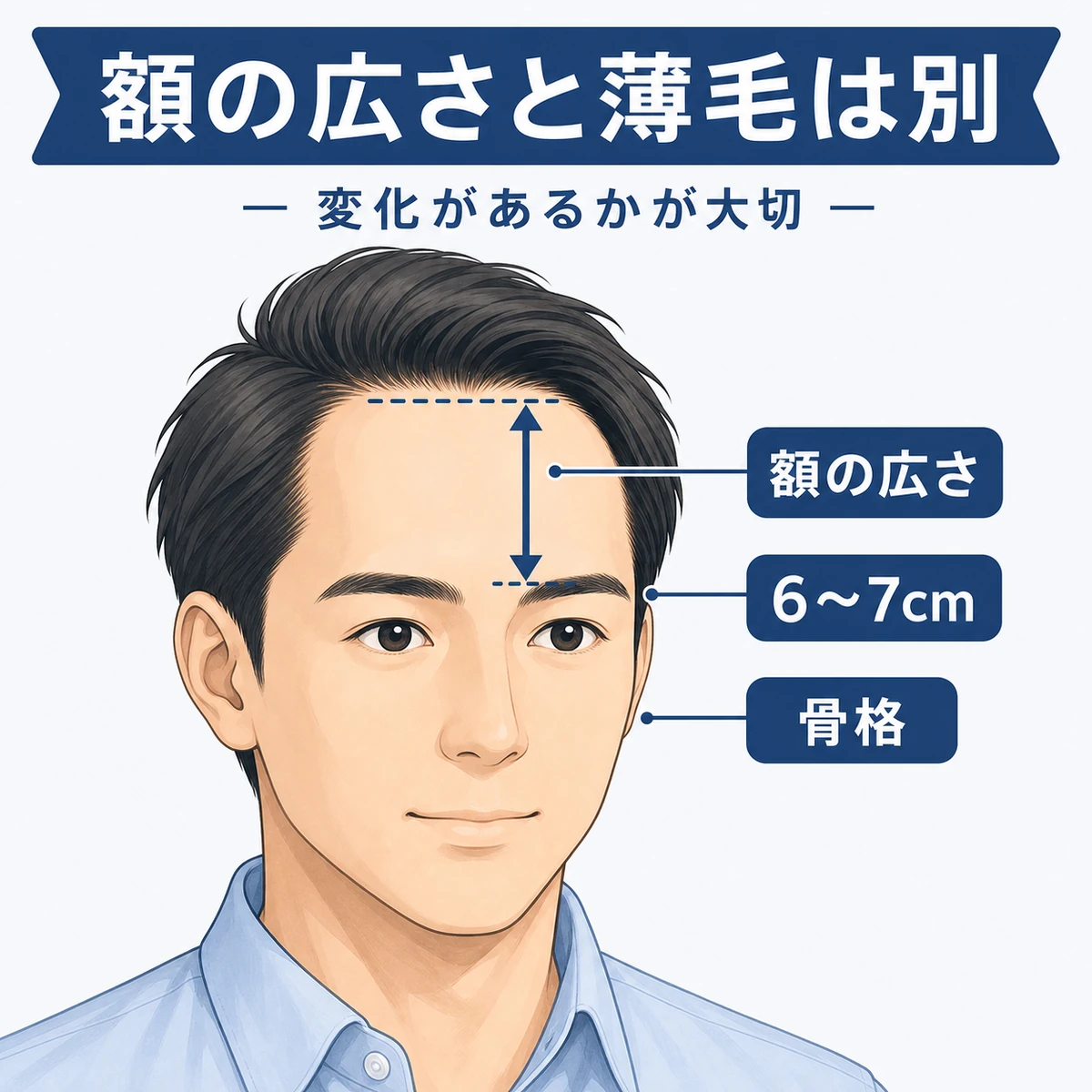 成人男性の額の広さの測り方を表した医療イラスト