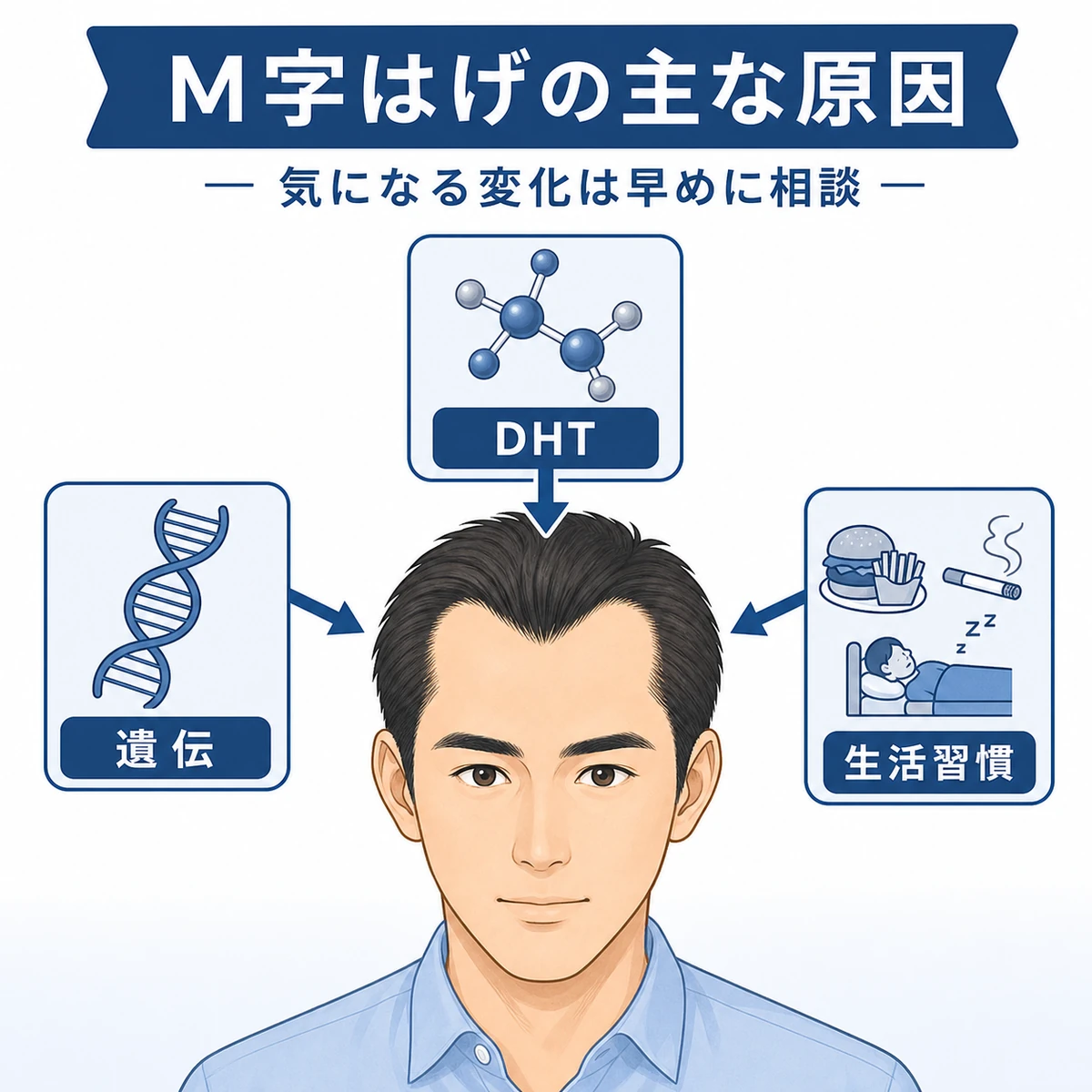 M字はげの主な原因と進行のしくみを表した医療イラスト