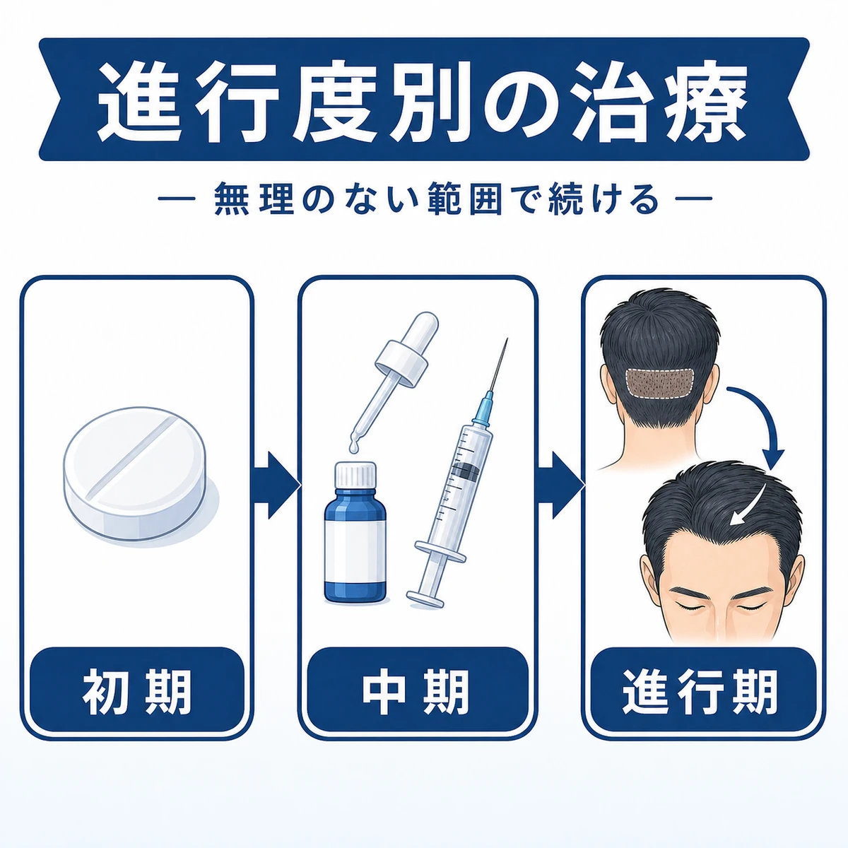 M字はげの進行度に応じた治療の進め方を示した医療イラスト