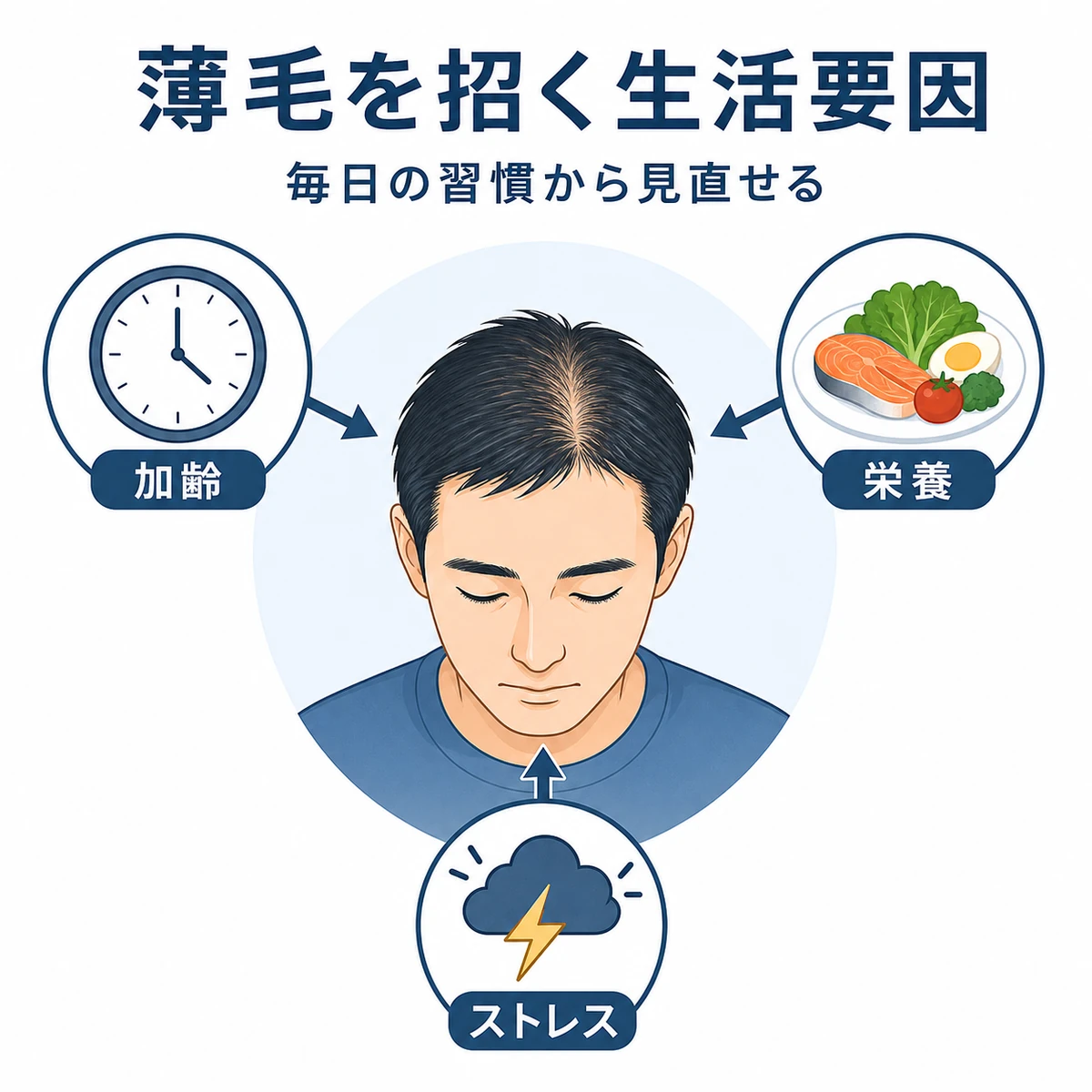 加齢や栄養不足やストレスが男性の薄毛につながる関係を示した医療イラスト