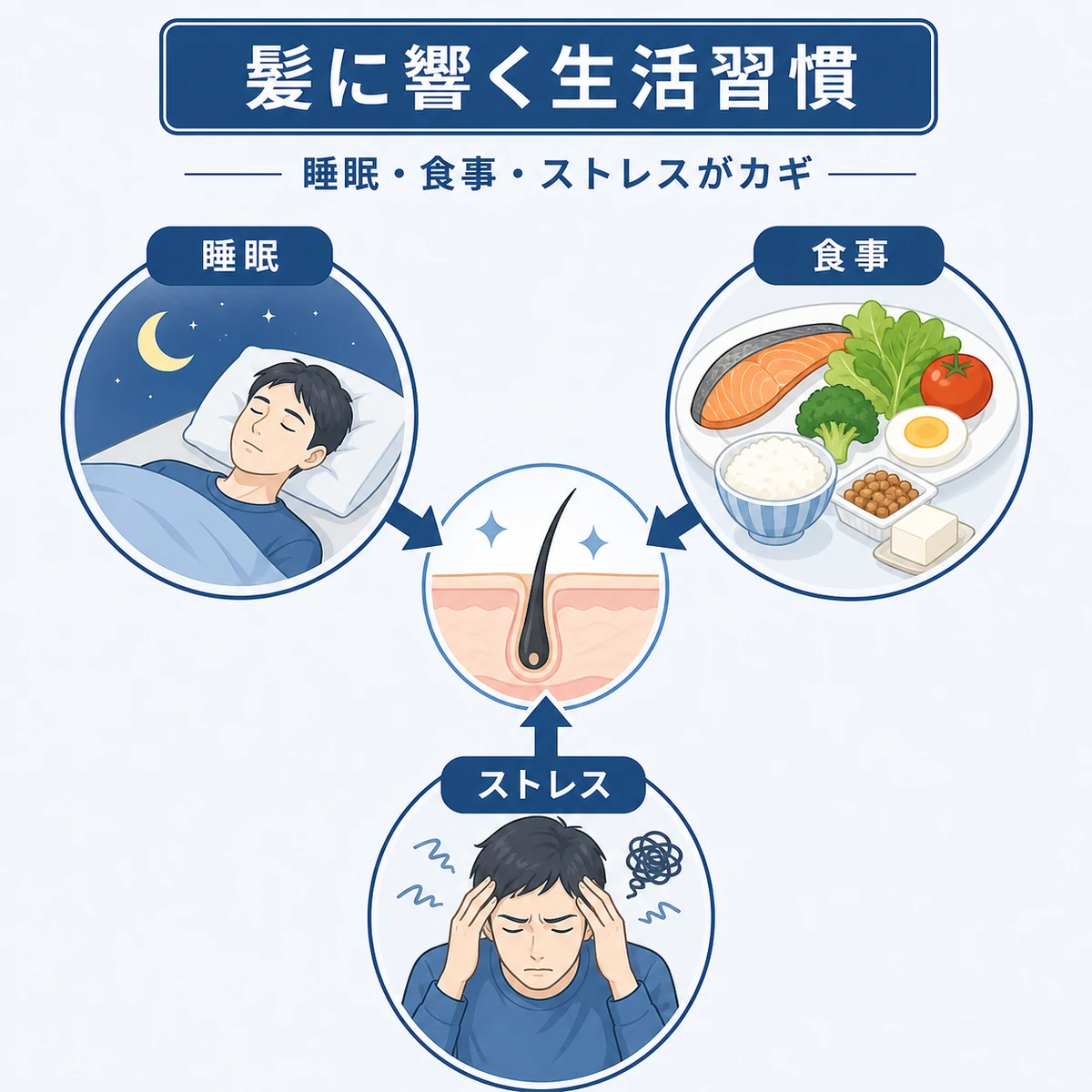 睡眠不足や偏った食事など抜け毛につながる生活習慣が頭皮に影響する関係を表した医療イラスト