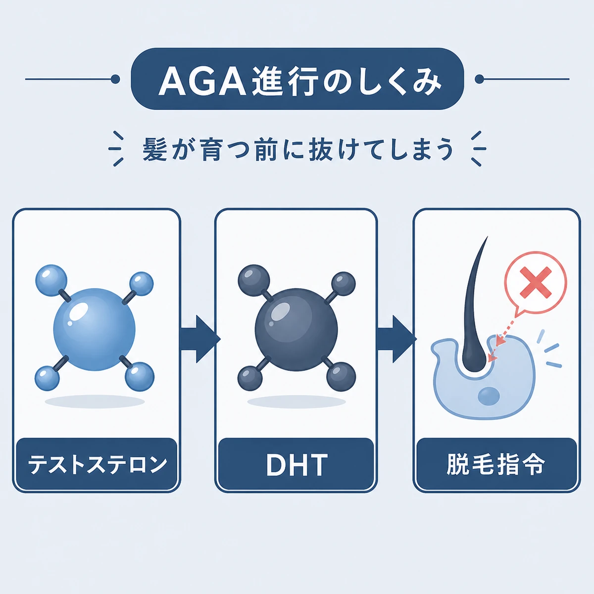 男性ホルモンが変化してDHTが作られAGAが進行する流れを表した医療イラスト