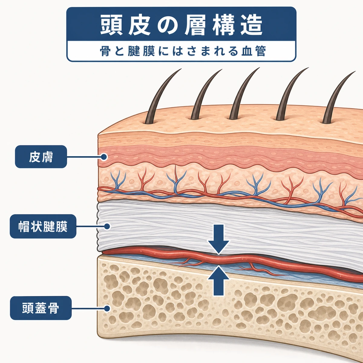 頭蓋骨と帽状腱膜の間に血管が挟まれる頭皮の層構造を表した断面の医療イラスト