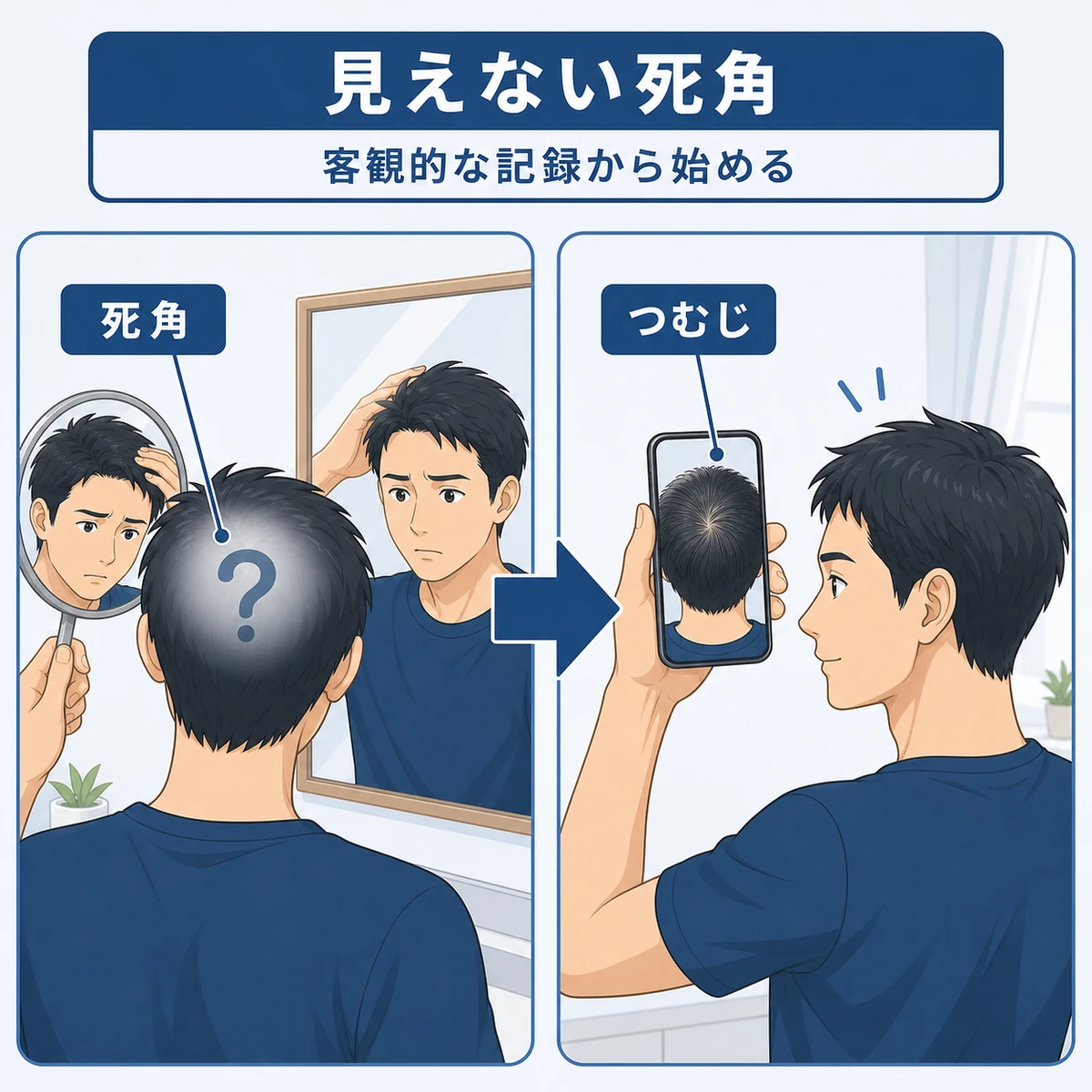 鏡では見えない頭頂部の死角とスマホ撮影による客観的な記録を対比した医療イラスト