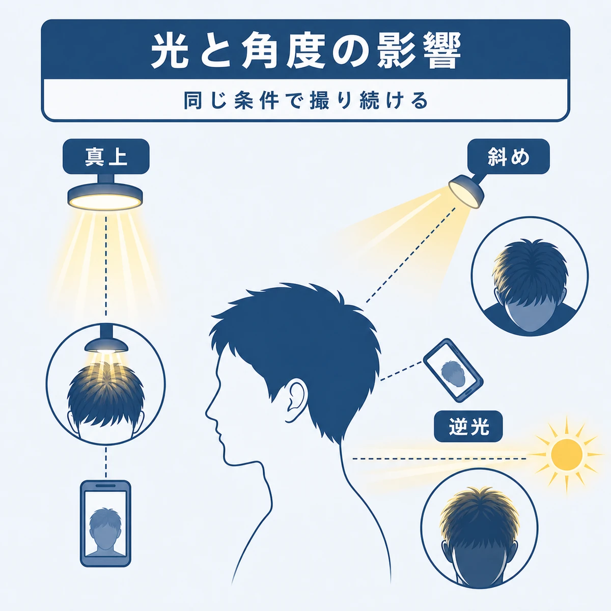 光の種類とカメラ角度による頭頂部の見え方の違いを側面図で比較した医療イラスト