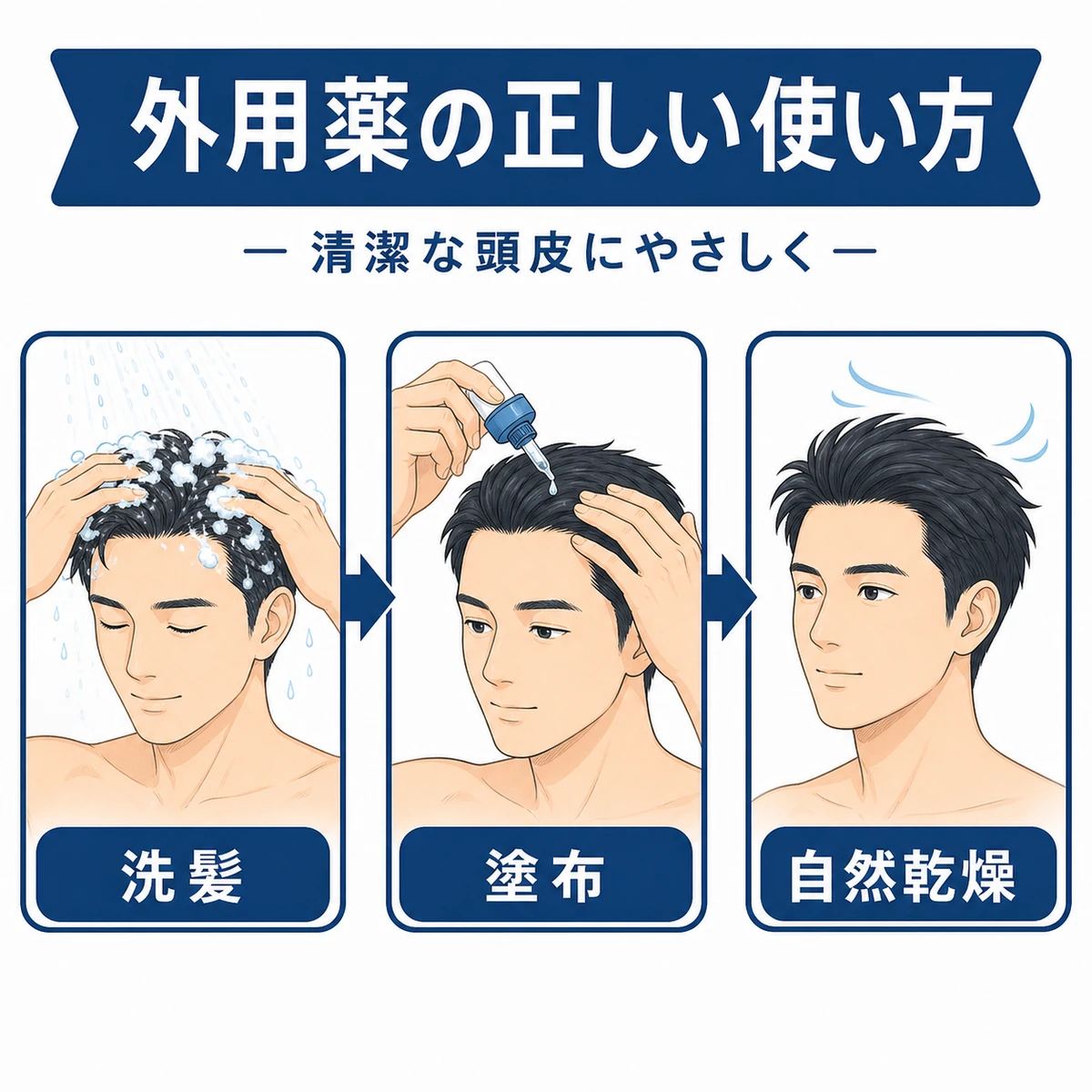 ミノキシジル外用薬を生え際に正しく塗る手順を表した医療イラスト