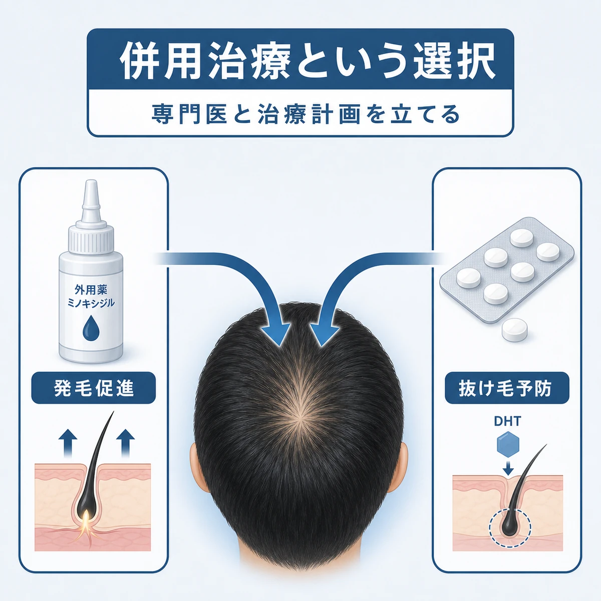 ミノキシジルともう一つの治療薬を併用する発毛促進と抜け毛予防の役割分担を表した医療イラスト