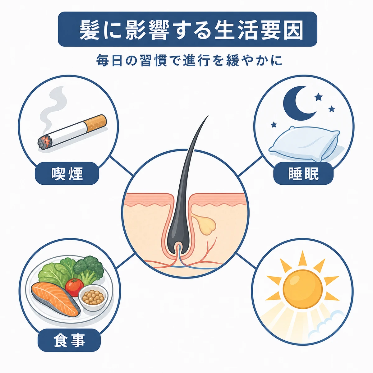 喫煙や飲酒、睡眠など頭皮環境に関わる生活要因を分類した医療イラスト