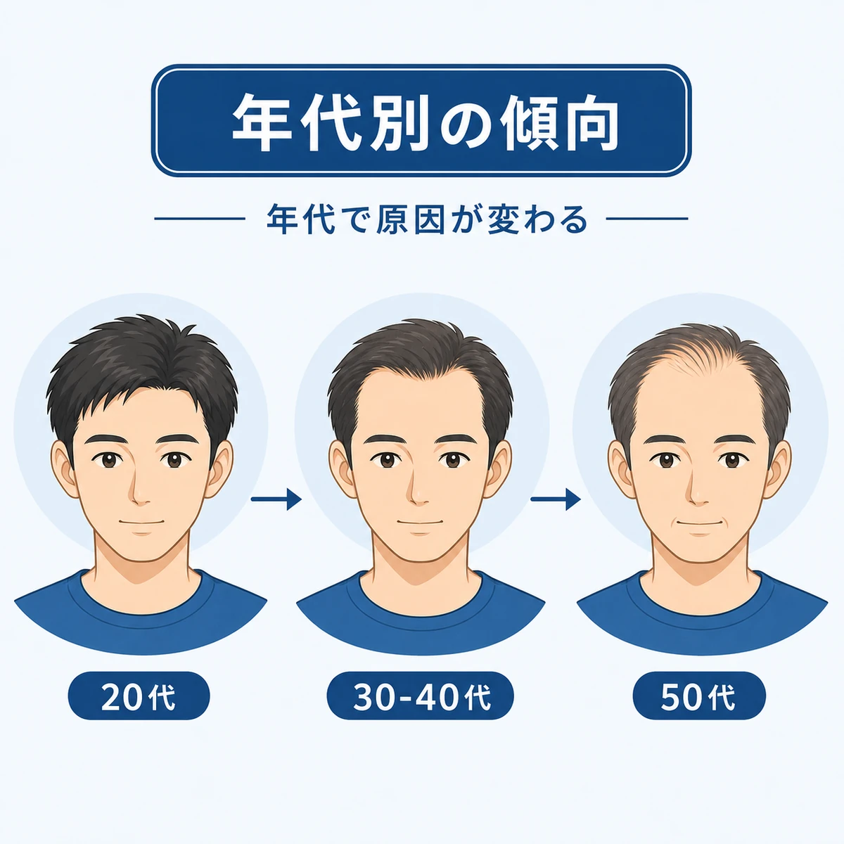 20代から50代までの抜け毛の傾向の変化を年代順に並べた医療イラスト