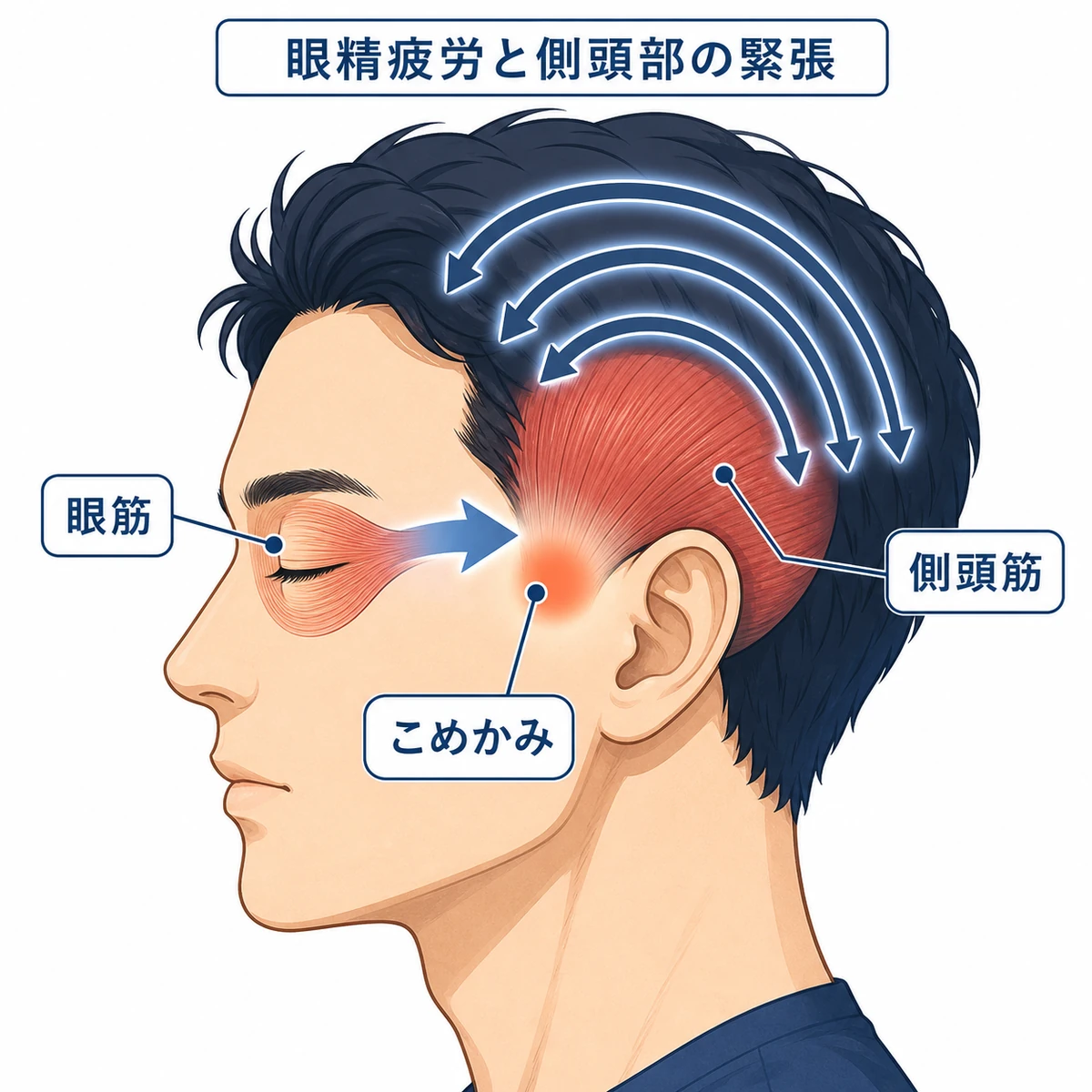 目の疲れが側頭部の筋肉を緊張させ髪に影響する仕組みを示した医療イラスト