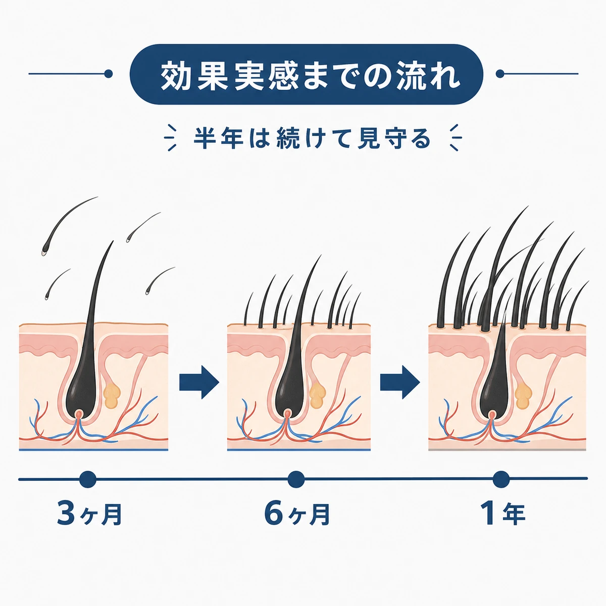 服用開始から効果を実感するまでの流れを表した医療イラスト