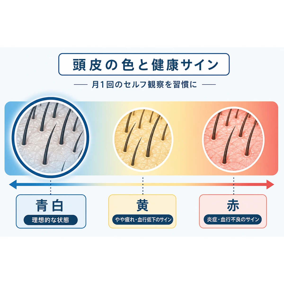 頭皮の色が青白いから赤へ移り変わる段階を並べた医療イラスト