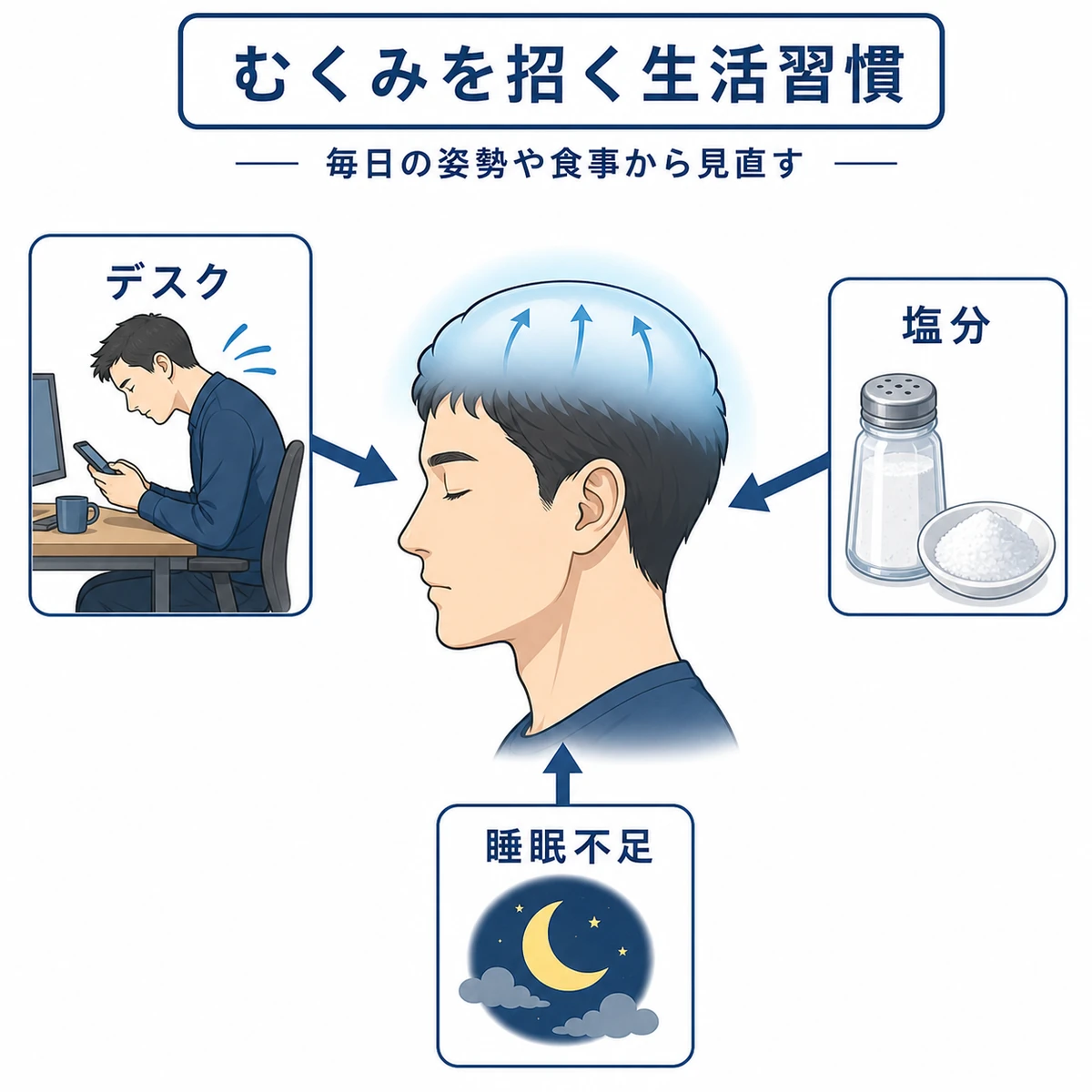 デスクワークや塩分過多などが成人男性の頭皮のむくみを招くしくみを描いた医療イラスト