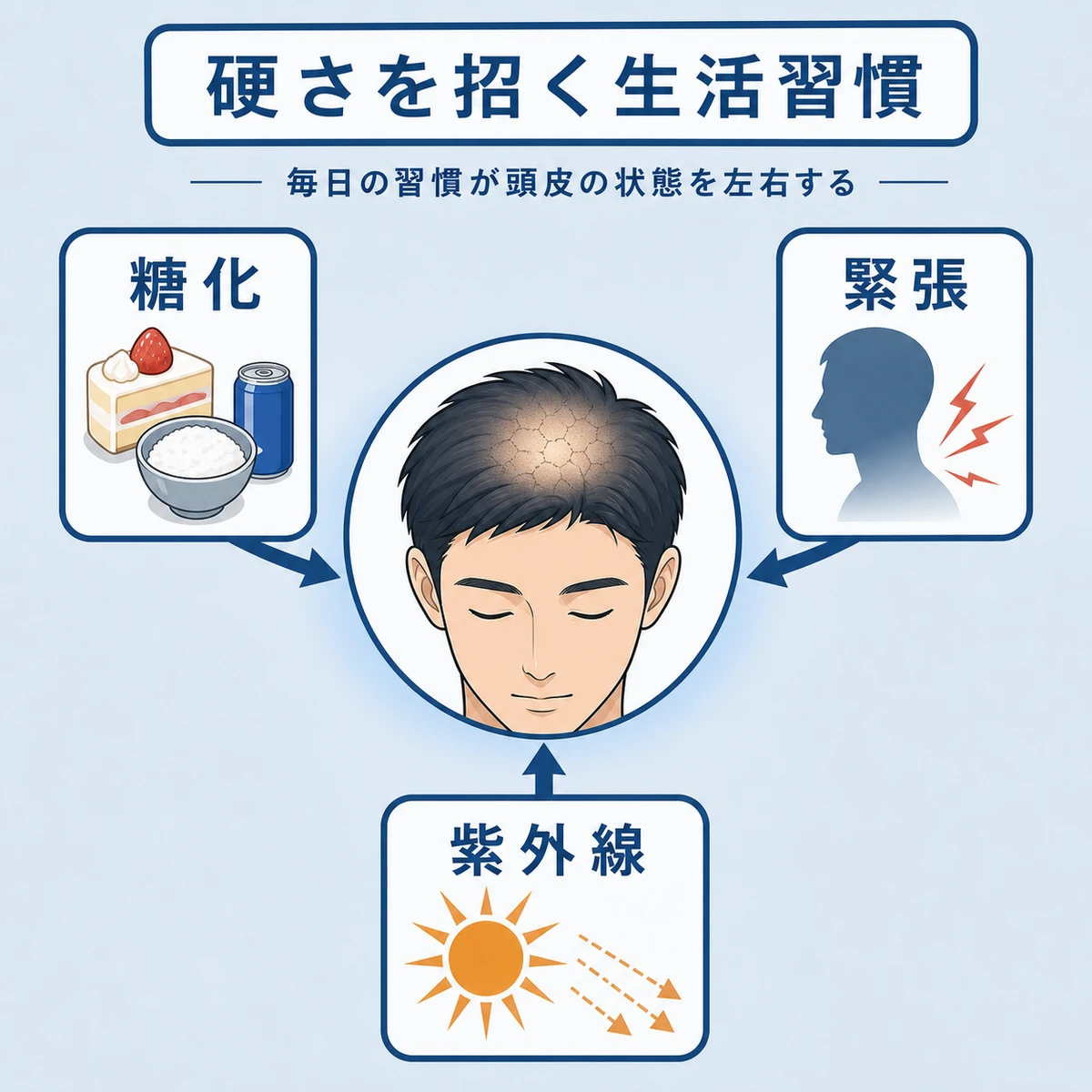 糖化や緊張や紫外線などの生活習慣が頭皮の硬化につながる要因を表した医療イラスト