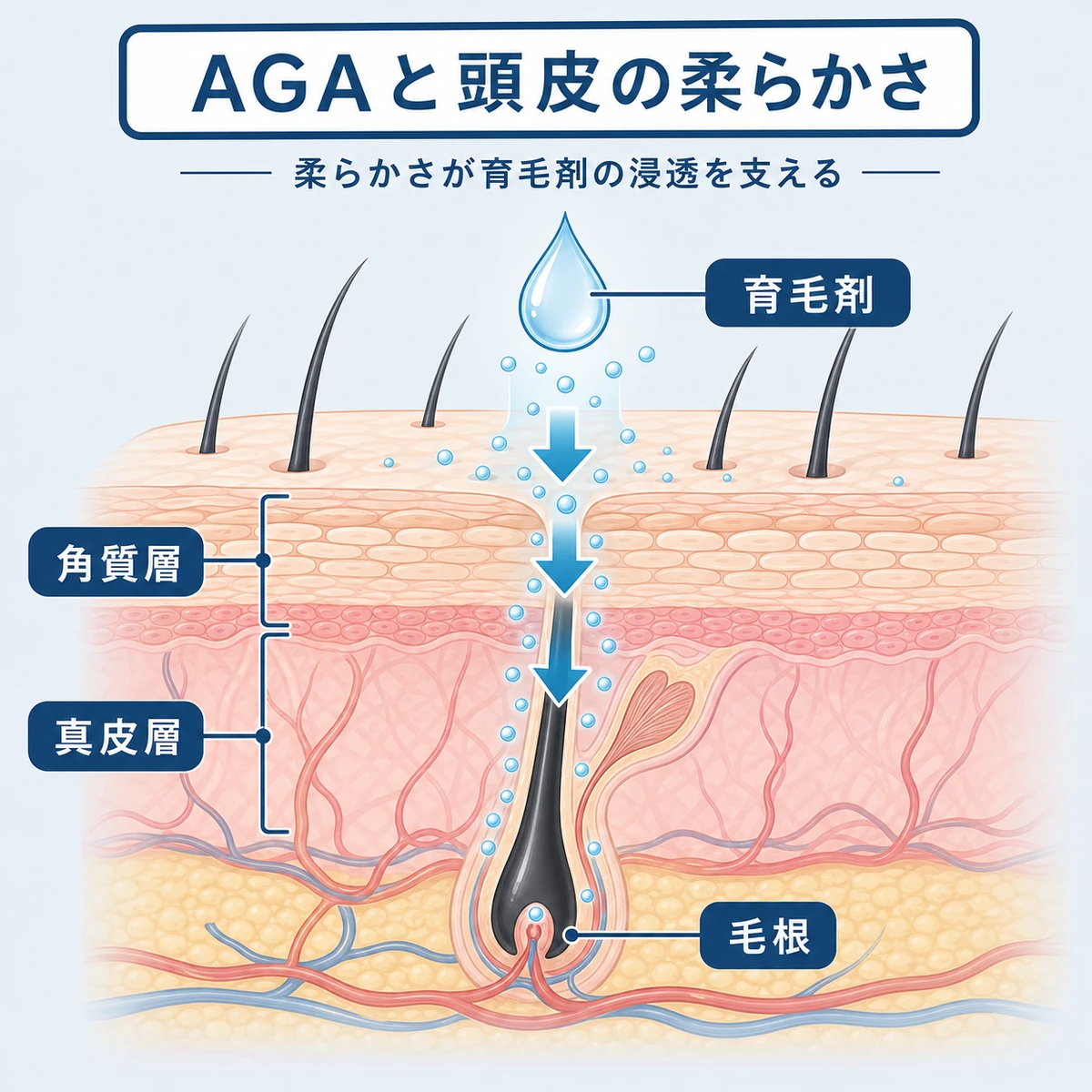 柔らかい頭皮の断面で育毛剤の成分が毛根へ浸透する様子を表した医療イラスト