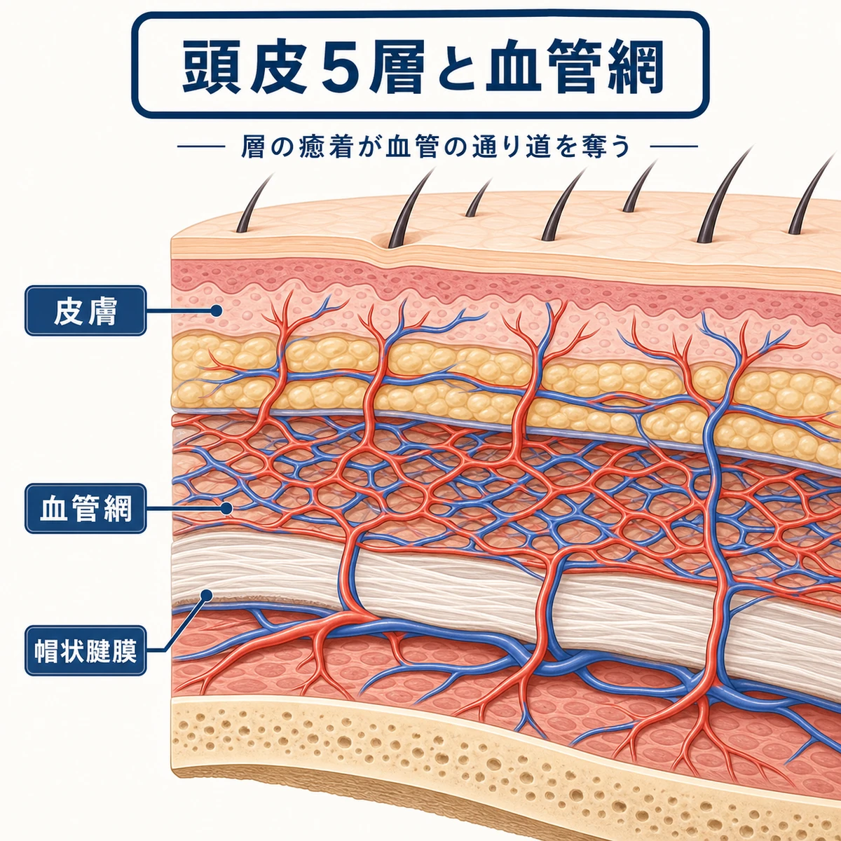 頭皮の5つの層と皮下組織に広がる毛細血管網の分布を描いた断面の医療イラスト