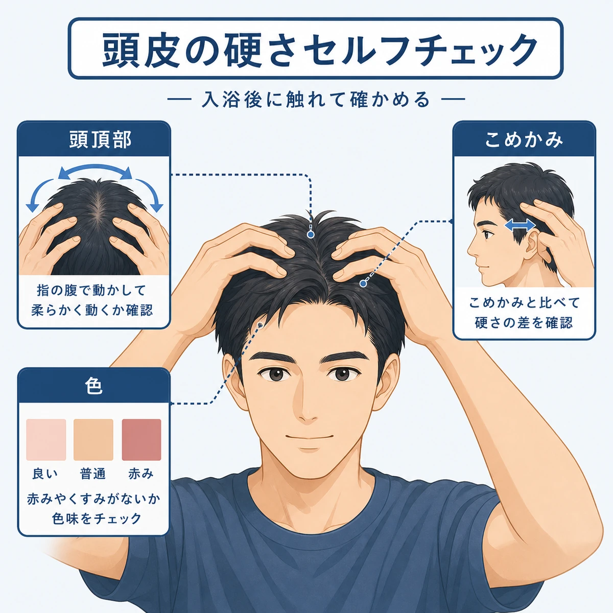 成人男性が頭頂部に触れて頭皮の硬さを確かめるセルフチェックの医療イラスト