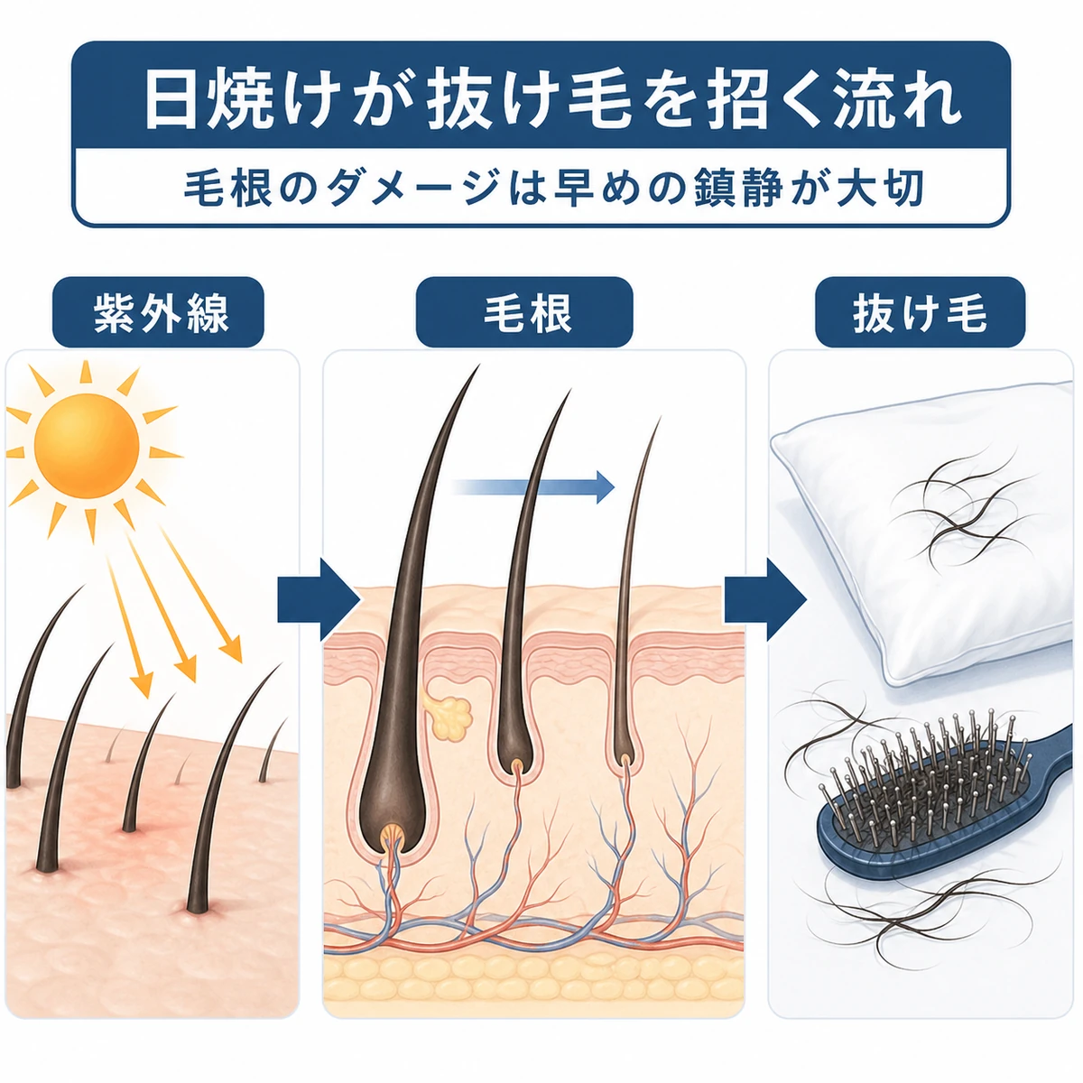 紫外線から毛根へのダメージが抜け毛につながる流れを示した医療イラスト
