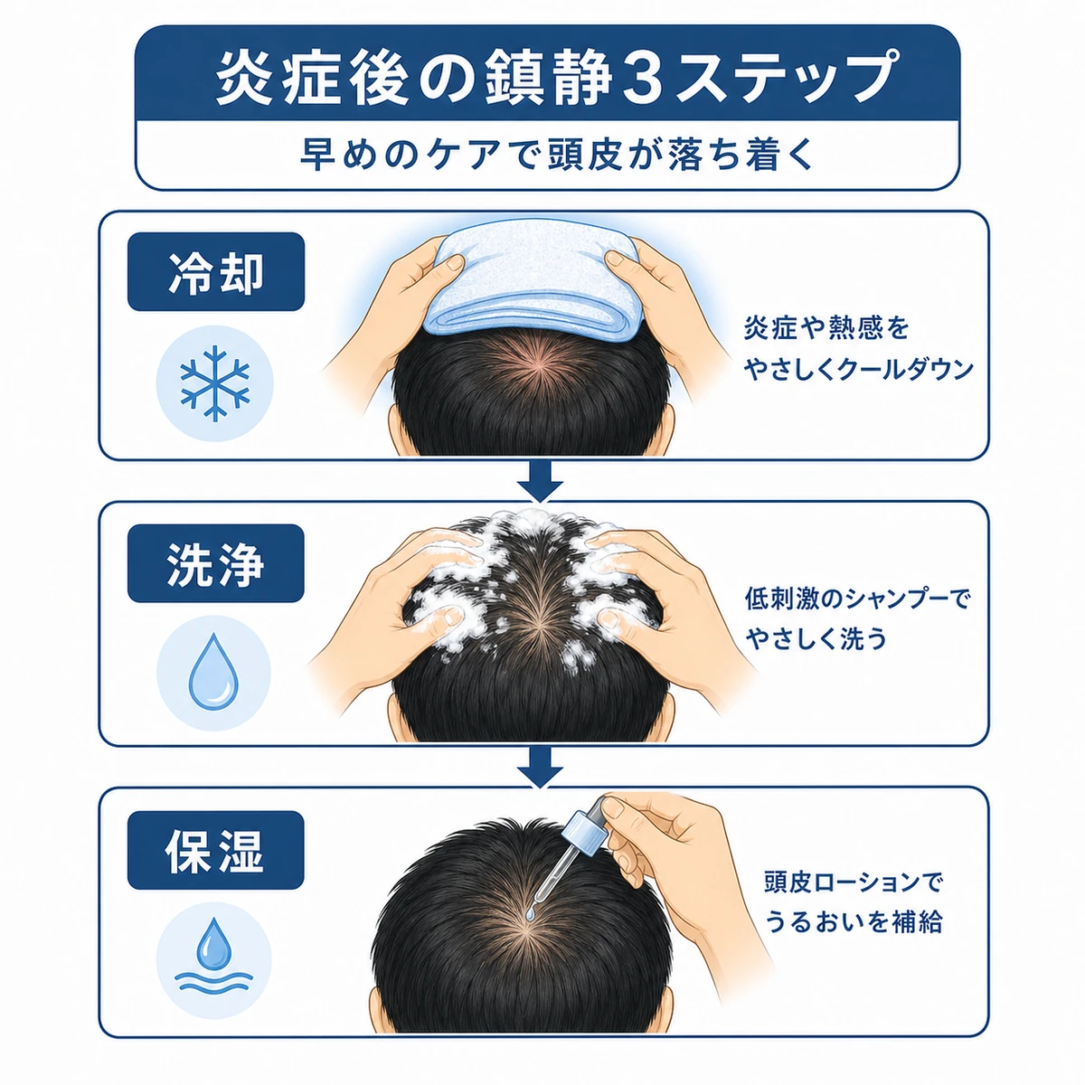 冷却から洗浄、保湿へと進む頭皮の鎮静ケア手順を表した医療イラスト