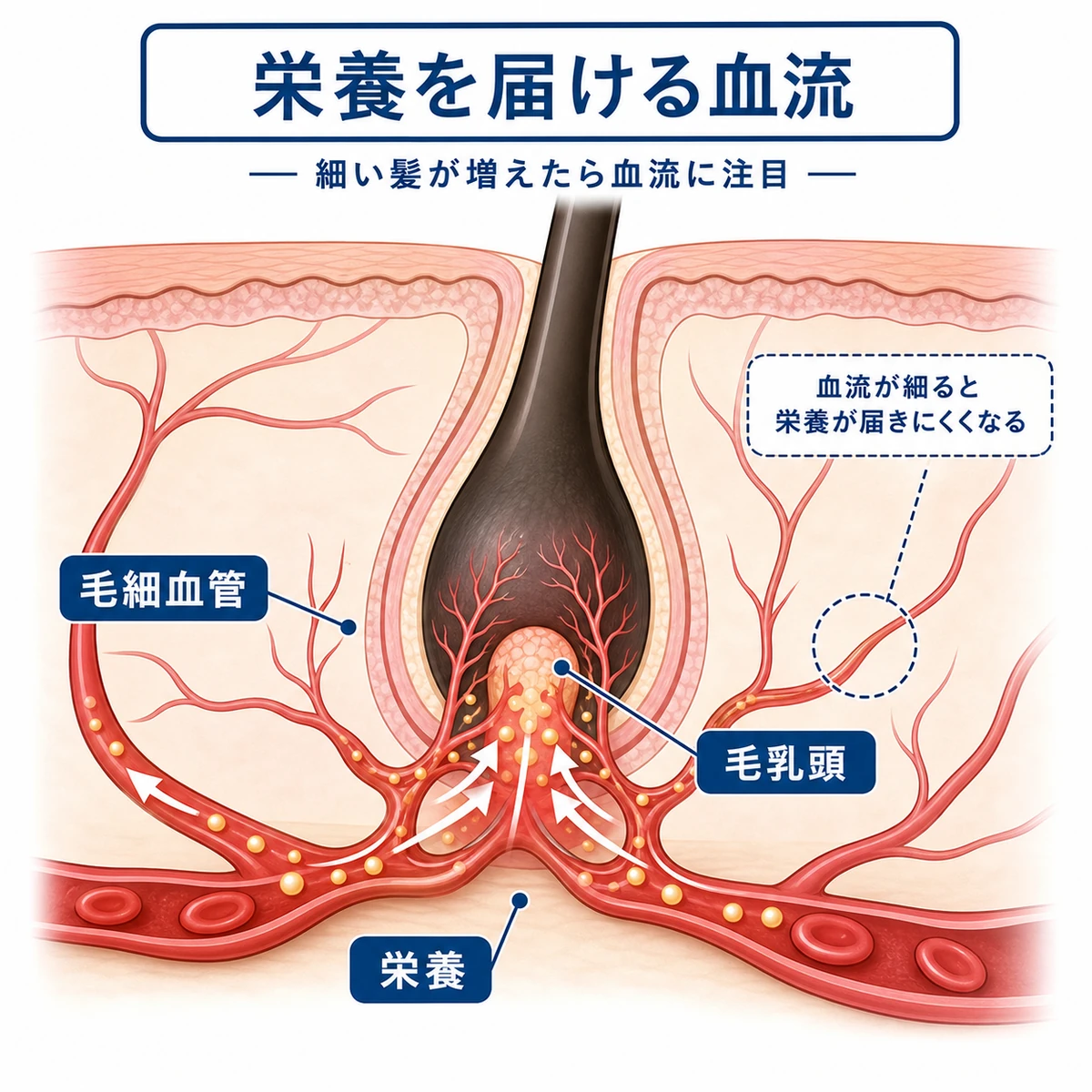 毛細血管から毛乳頭へ栄養が届く流れと血行不良の影響を表した毛根の断面イラスト