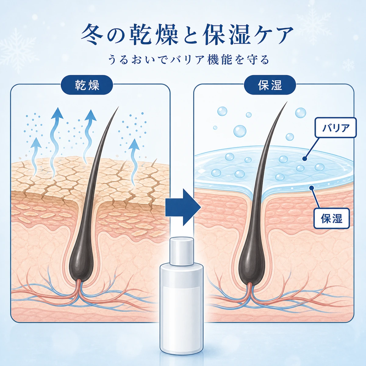 冬の乾燥した頭皮と保湿で整った頭皮を比べた医療イラスト