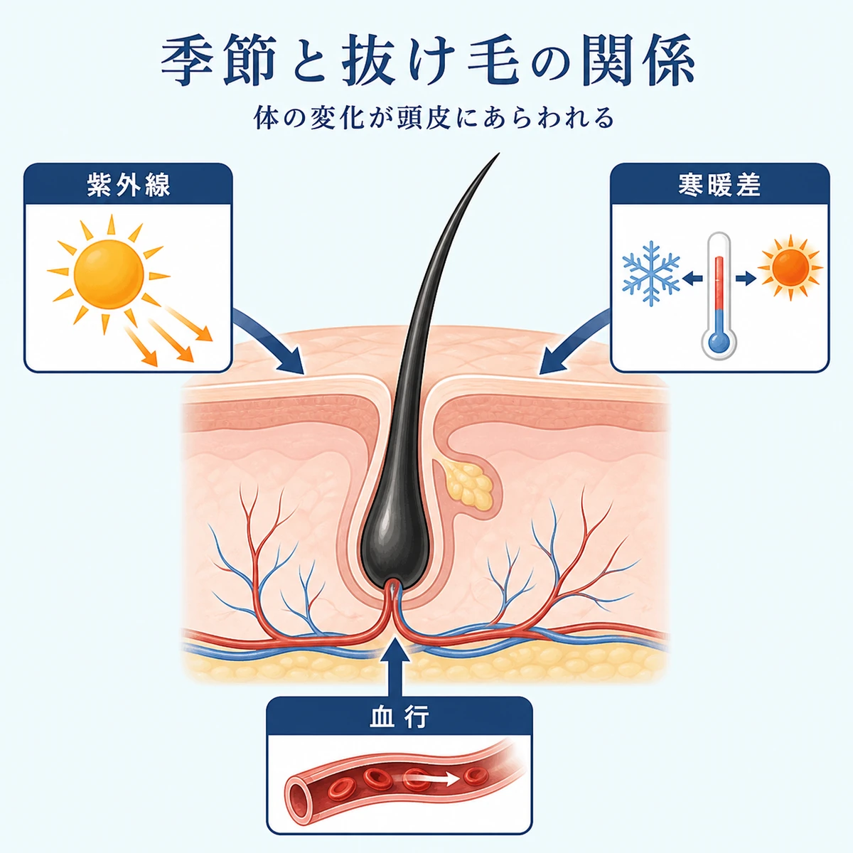 紫外線や寒暖差や血行不良が頭皮の毛根に影響する仕組みを表した医療イラスト
