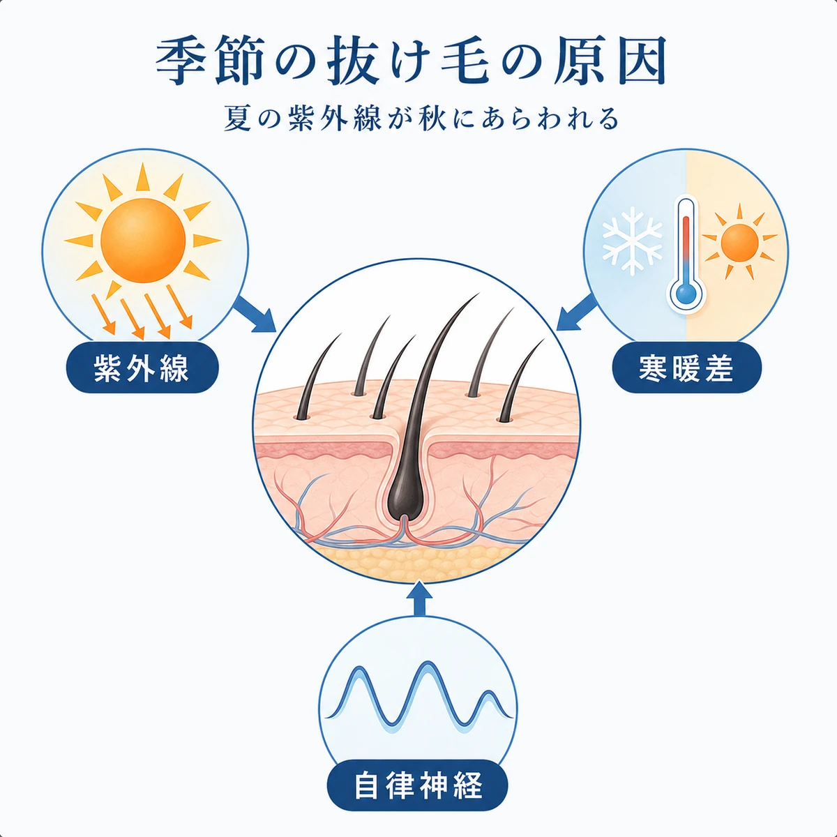 紫外線や寒暖差や自律神経の乱れが頭皮に影響して抜け毛が増える流れを示した医療イラスト