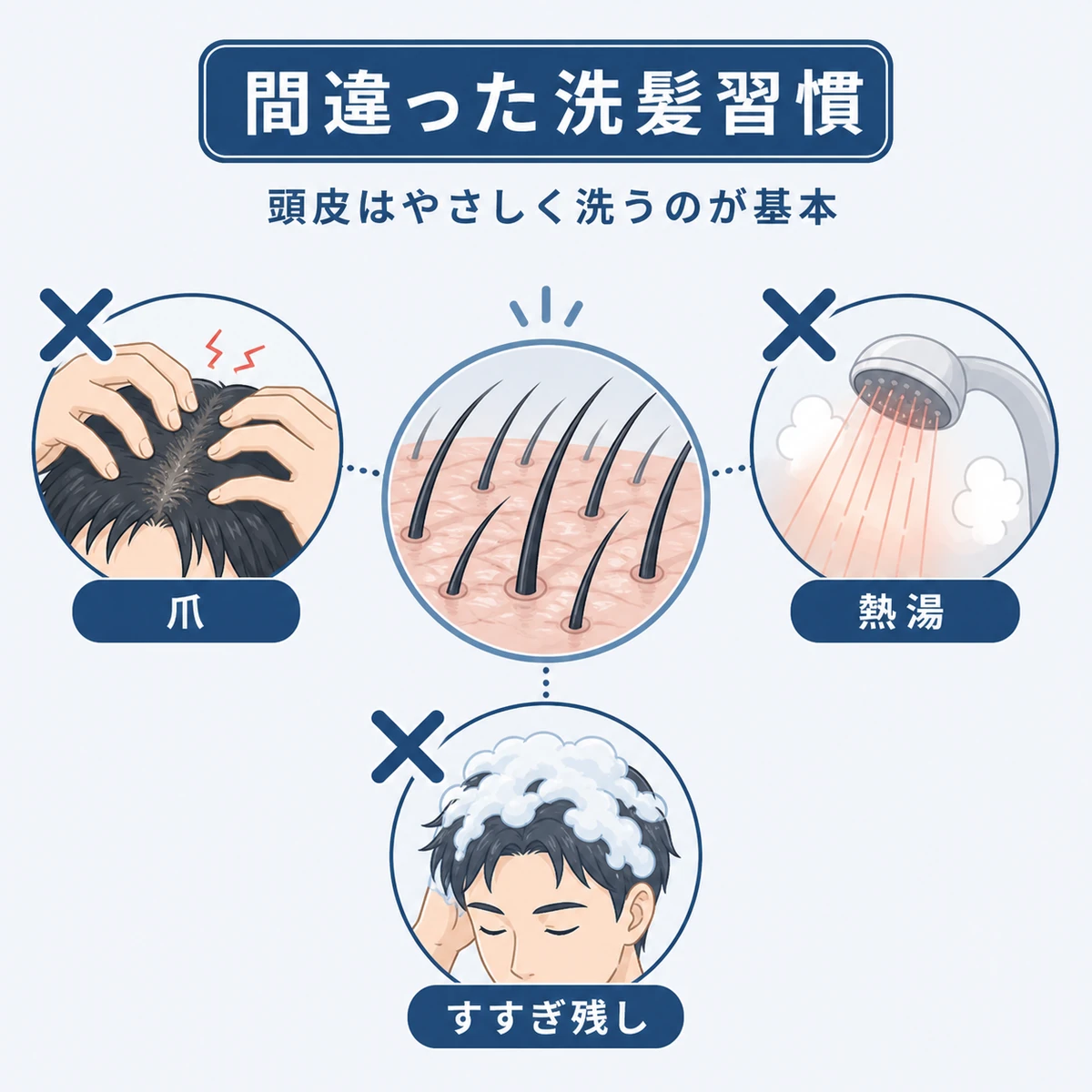 爪での摩擦や熱いお湯など抜け毛を招く誤った洗髪習慣を集めた医療イラスト