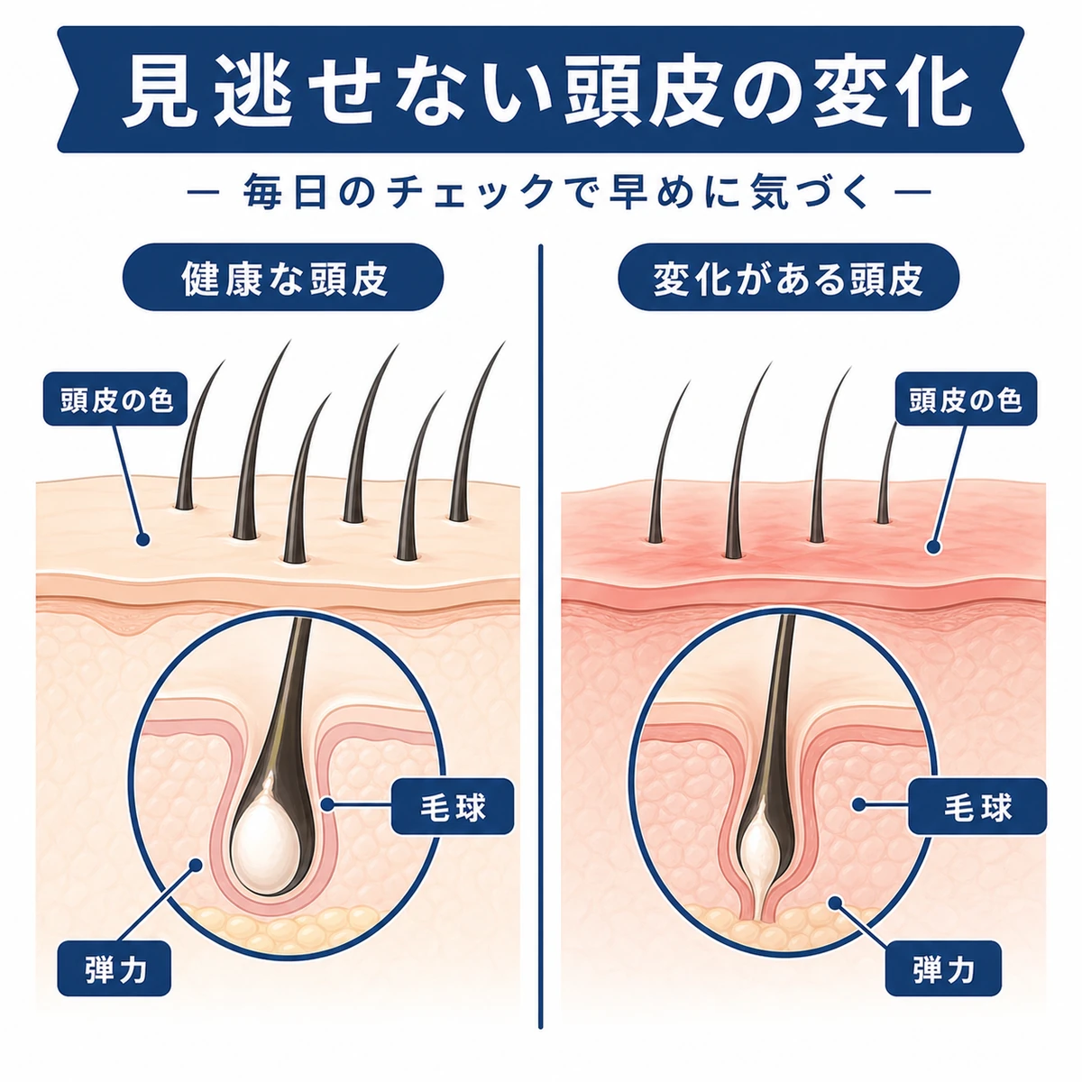 健康な頭皮や毛球と注意したい状態の違いを並べて表した医療イラスト