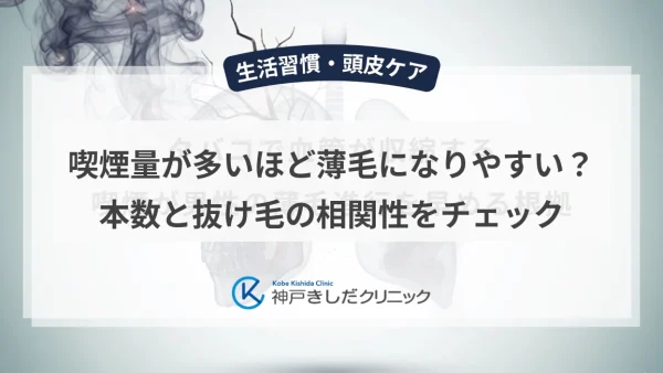 喫煙量が多いほど薄毛になりやすい？本数と抜け毛の相関性をチェック