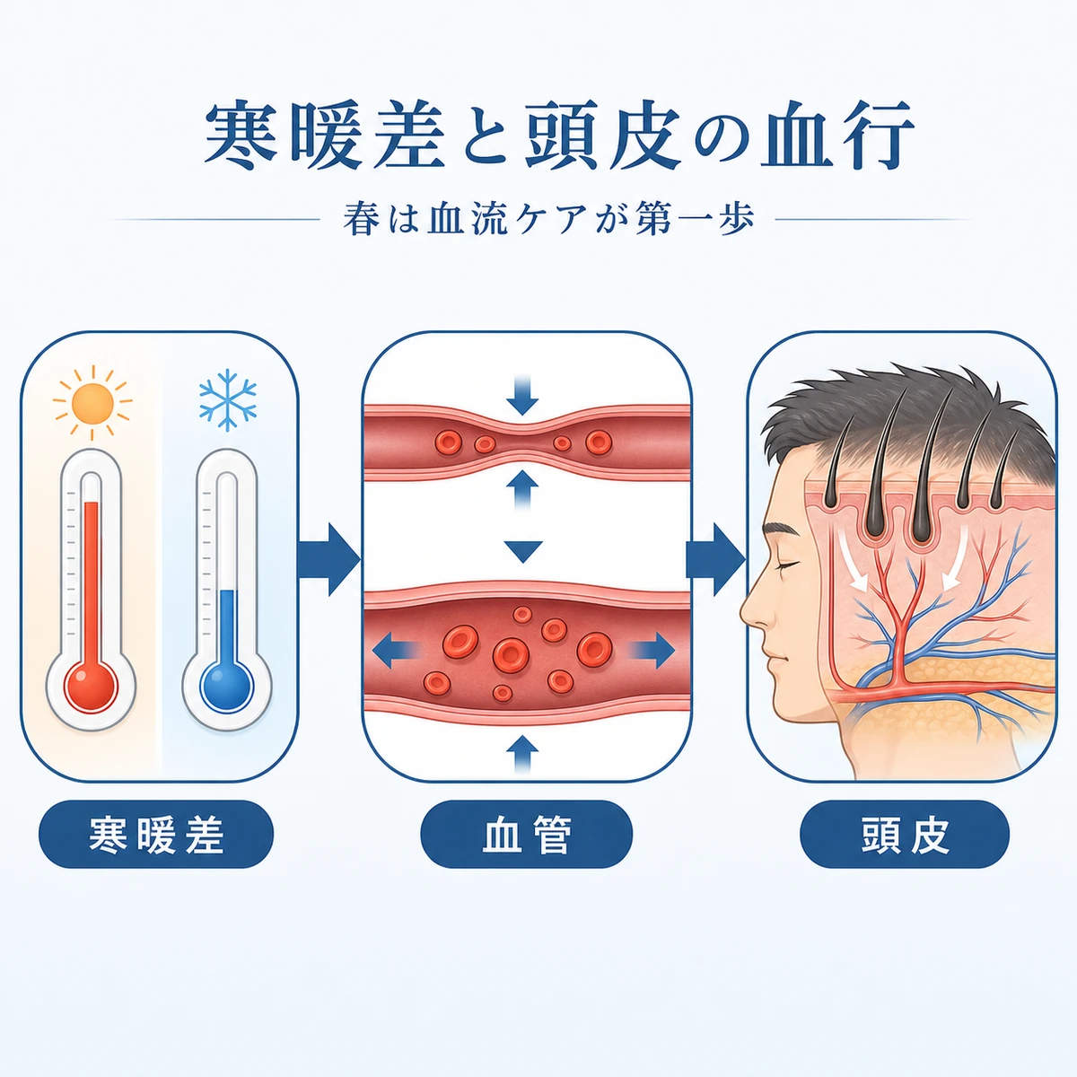 春の寒暖差で頭皮の血行が滞るしくみを表した医療イラスト