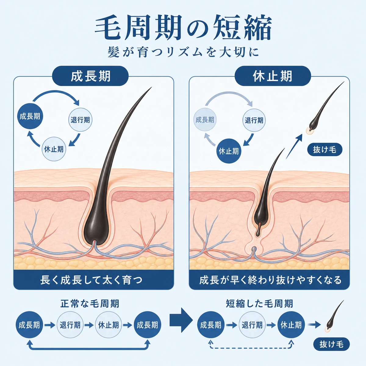 自律神経の乱れで毛周期が短くなる流れを表した医療イラスト