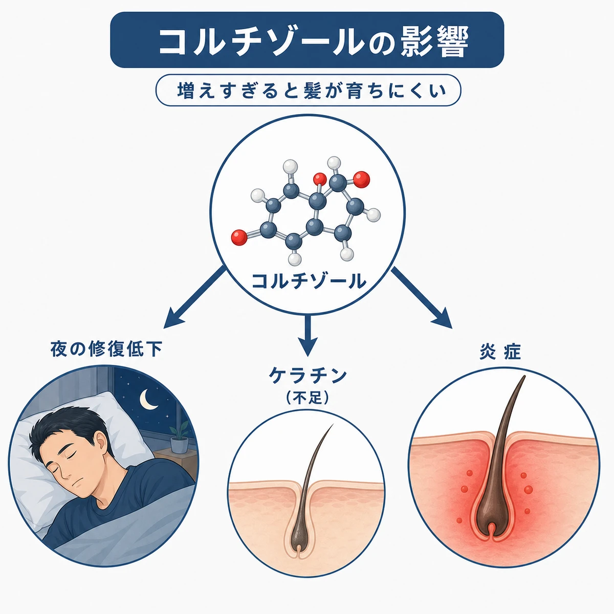 コルチゾールが髪に与える三つの影響を表した医療イラスト