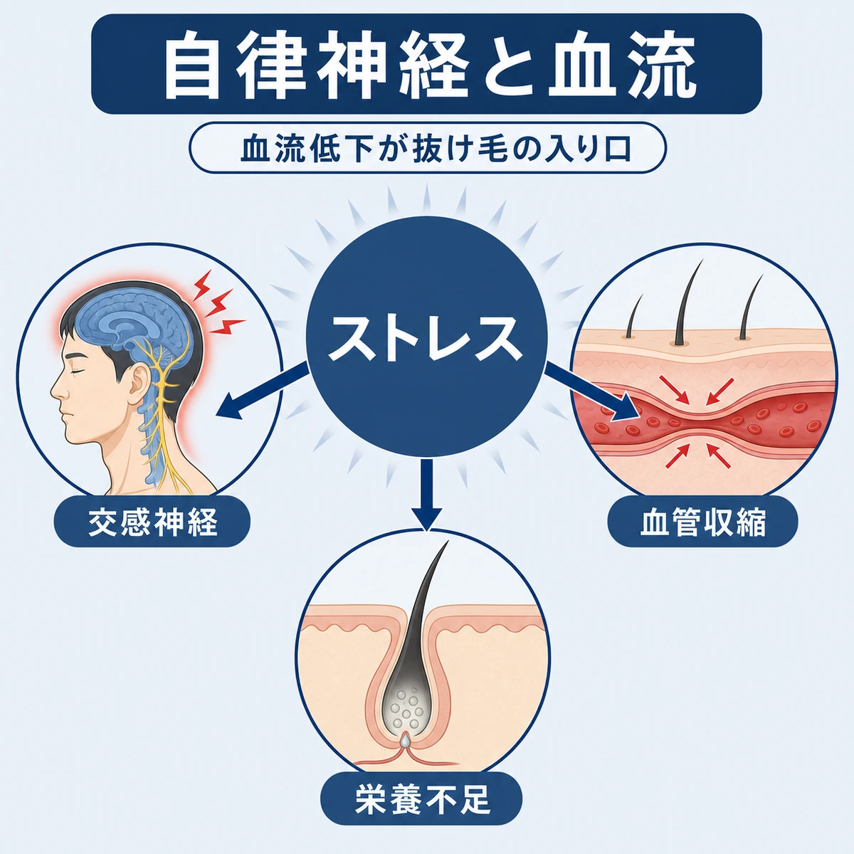 ストレスによる自律神経の乱れが頭皮の血流低下と栄養不足を招く流れを表した医療イラスト