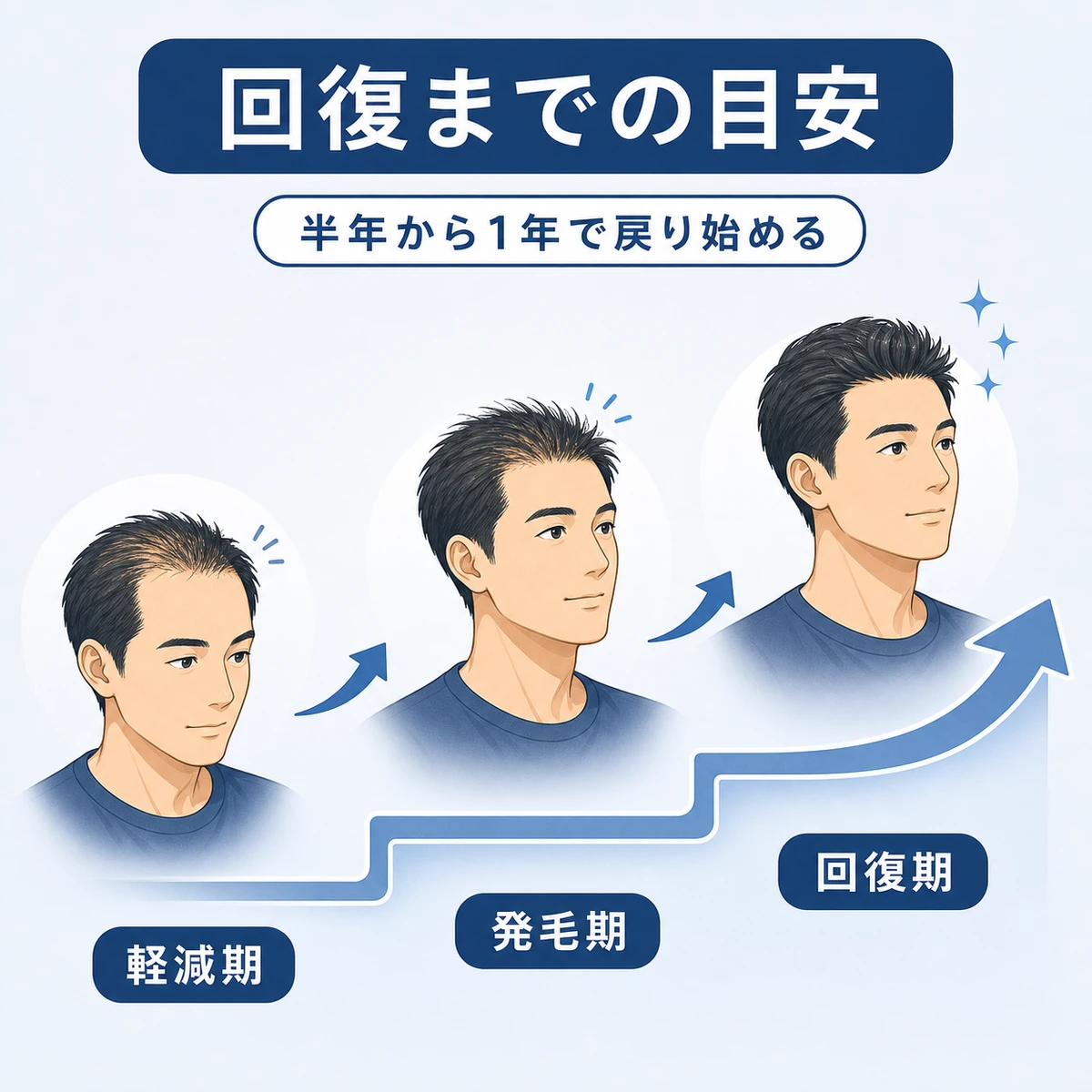 ストレス性の薄毛が軽減から発毛を経て回復へ向かう道のりを段階で表した医療イラスト