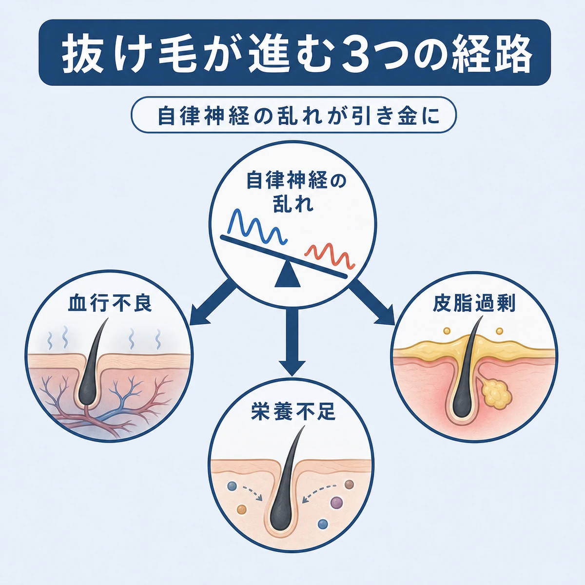 自律神経の乱れが抜け毛を加速させる3つの経路を表した医療イラスト