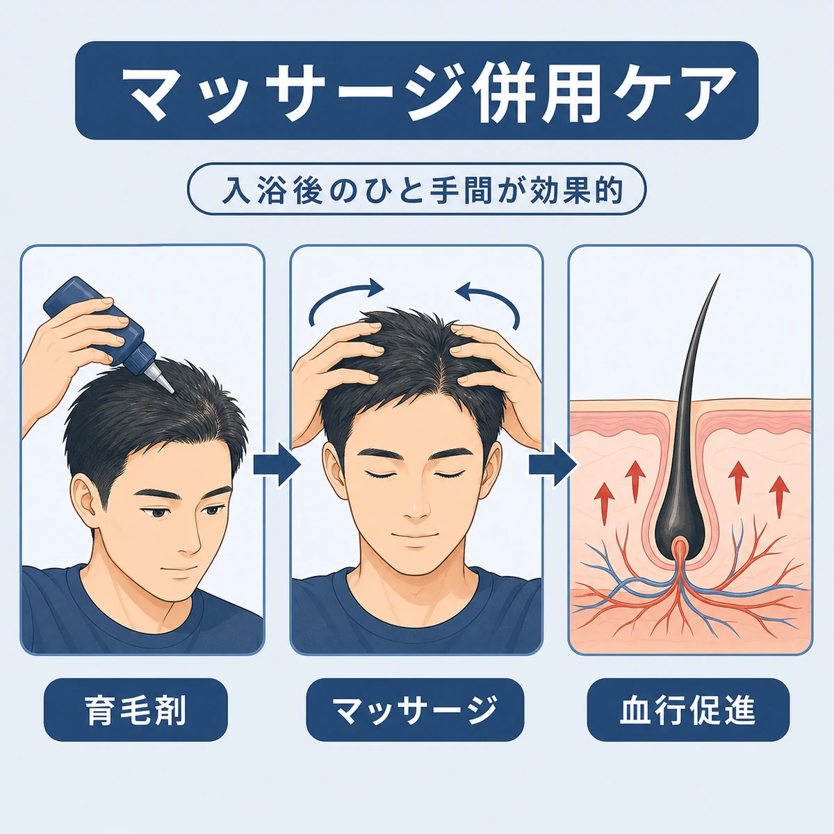 頭皮マッサージと育毛剤の併用で血行を促すケアの流れを表した医療イラスト
