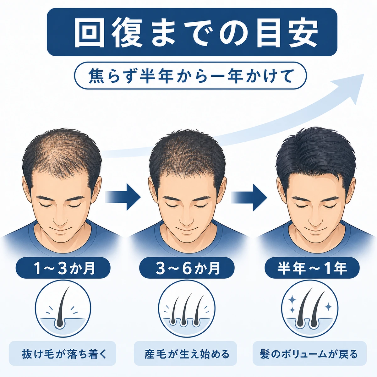 抜け毛が落ち着き毛量が戻るまでの回復期間を段階で示した医療イラスト