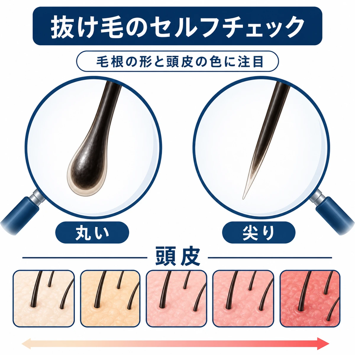 抜け毛の毛根の形や頭皮の状態を見分けるセルフチェックの医療イラスト