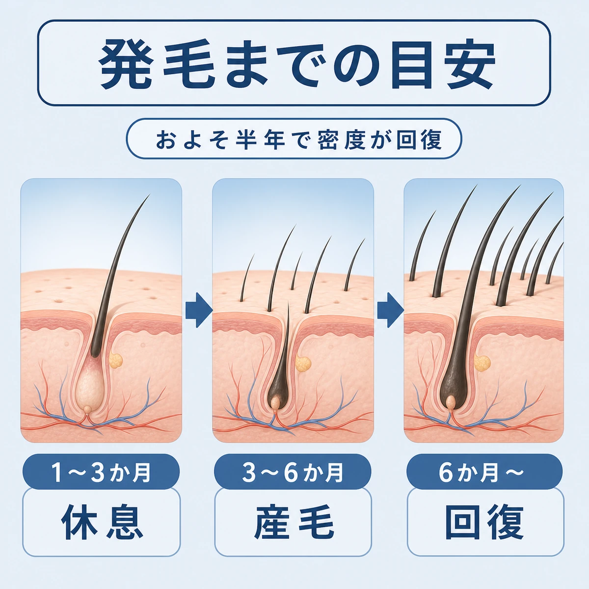 抜けた髪が産毛から太い毛へ育っていく回復の時間軸を表した医療イラスト