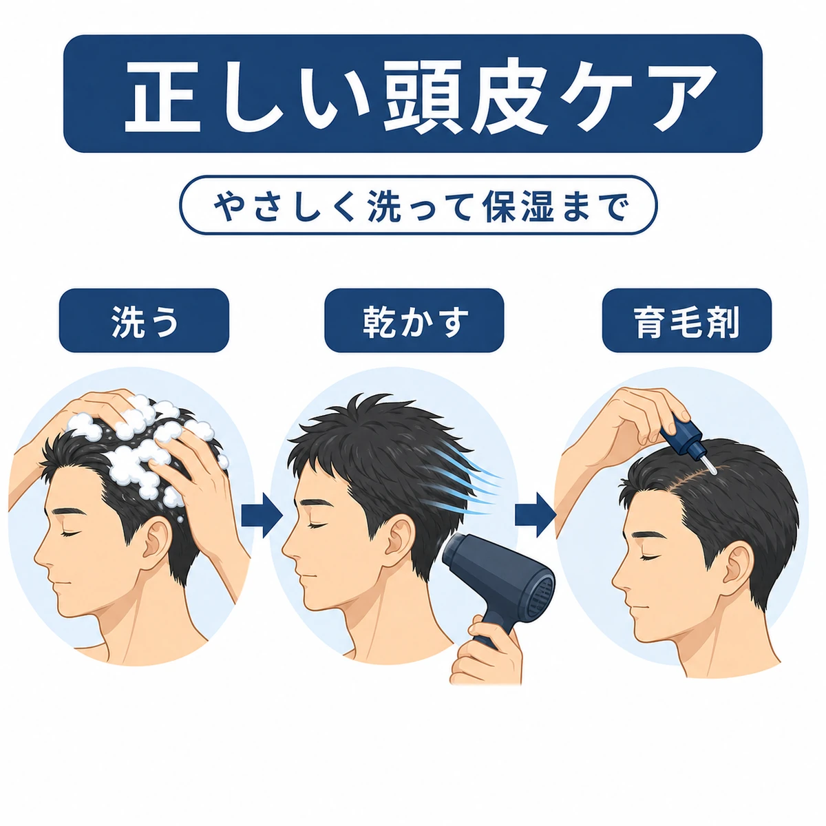 やさしい洗髪から育毛剤までの正しい頭皮ケアの流れを表した医療イラスト