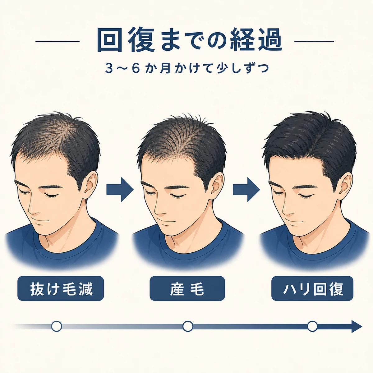 抜け毛が止まり産毛からハリのある髪へ回復していく経過を左から右への流れで表した医療イラスト
