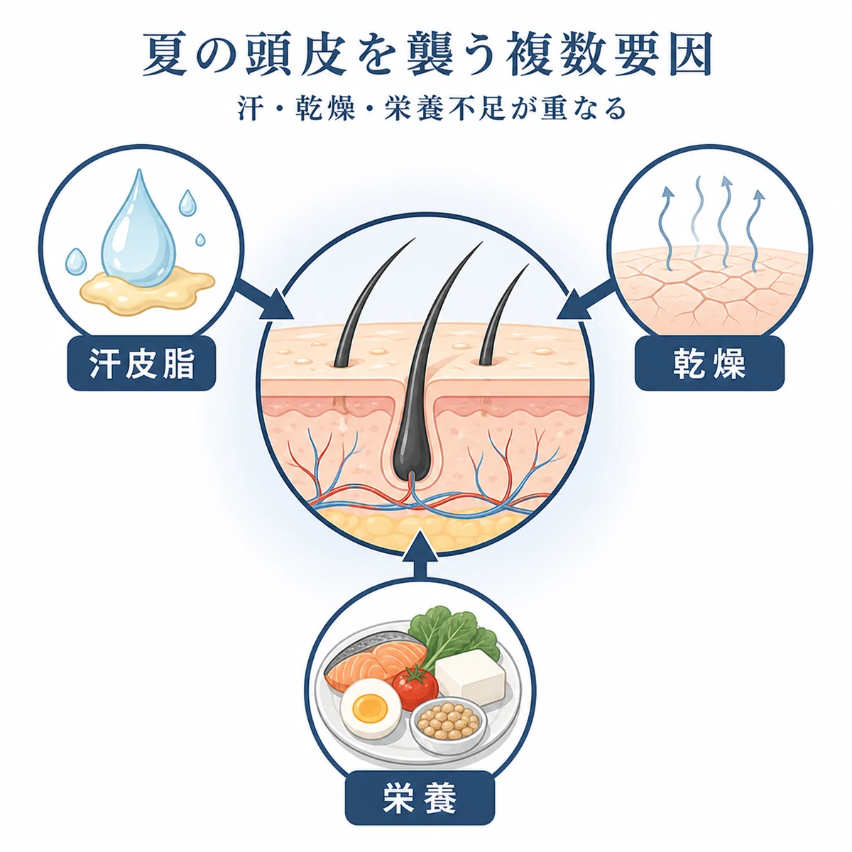 汗や乾燥や栄養不足など夏の抜け毛要因が頭皮に重なる様子を表した医療イラスト