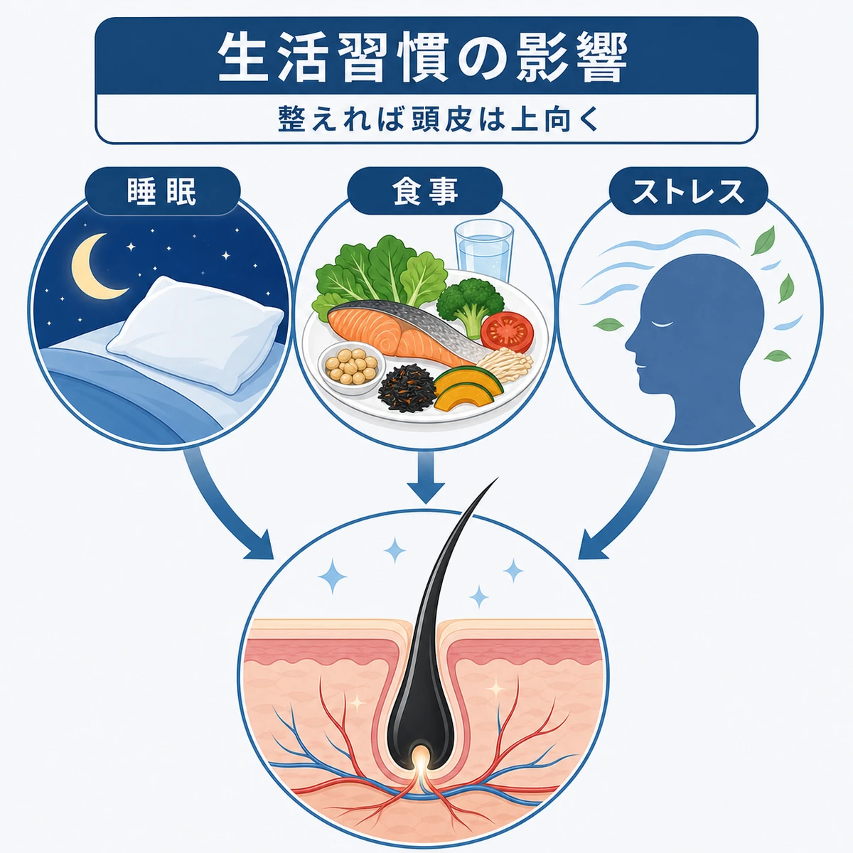 睡眠・食事・ストレスといった生活習慣が頭皮環境に与える影響を結びつけて表した医療イラスト
