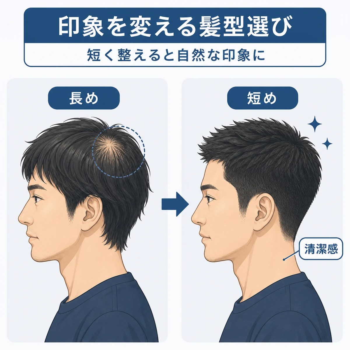 髪の長さによる頭頂部の見え方の違いを左右で比べた男性ヘアの解説イラスト