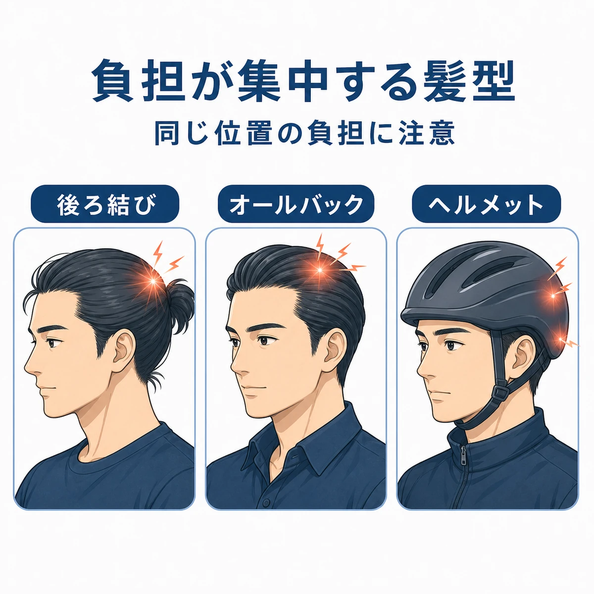 後ろ結びやオールバック、きついヘルメットなど負担の集中しやすい成人男性の髪型を並べた医療イラスト