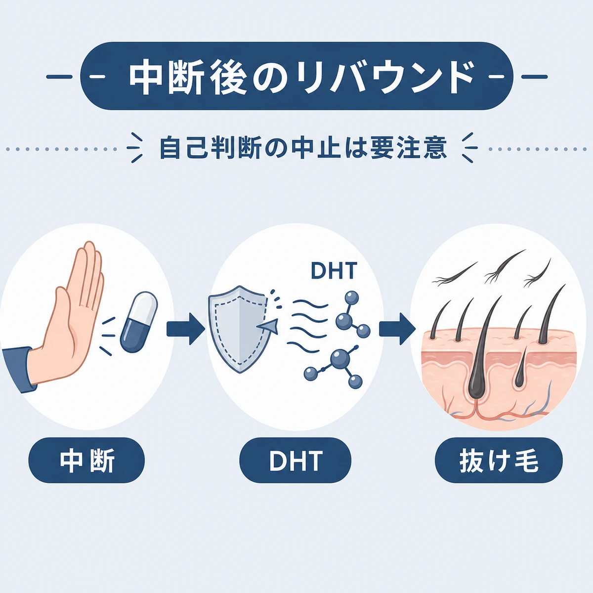 治療中断でDHTが再び活性化し抜け毛が増えていく流れを表した医療イラスト